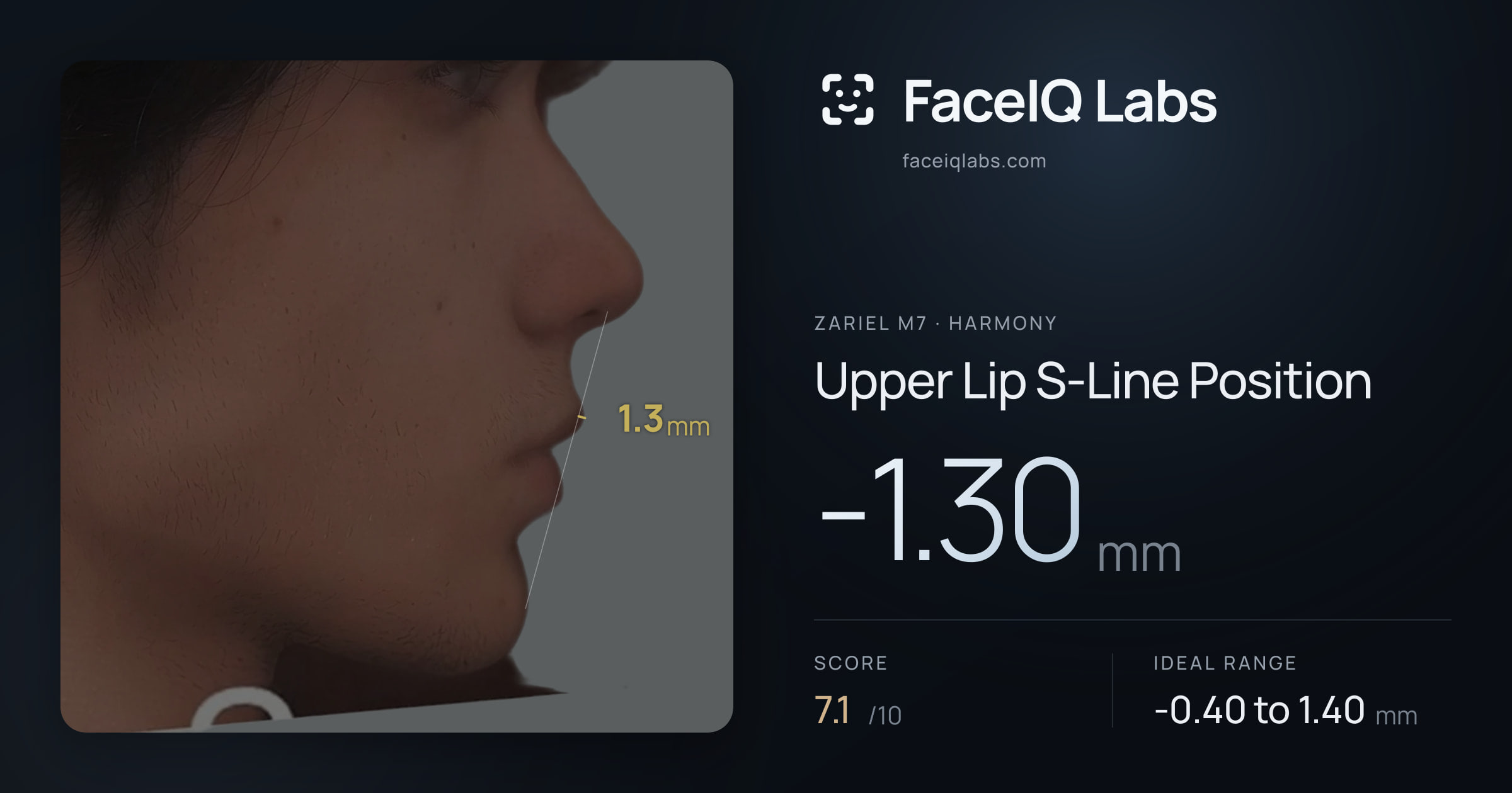 Zariel M7 Upper Lip S-Line Position: -1.30mm, drawn on the photo