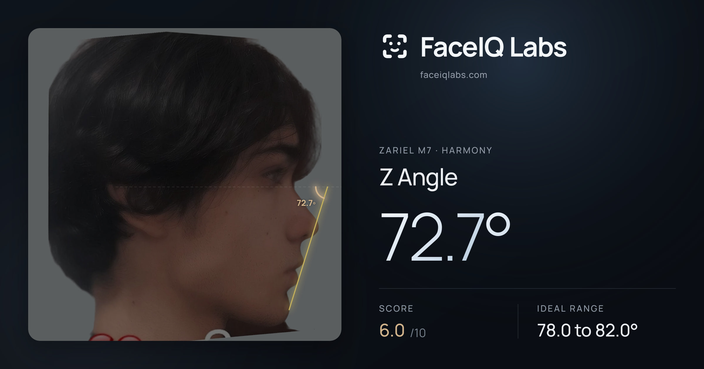 Zariel M7 Z Angle: 72.7°, drawn on the photo