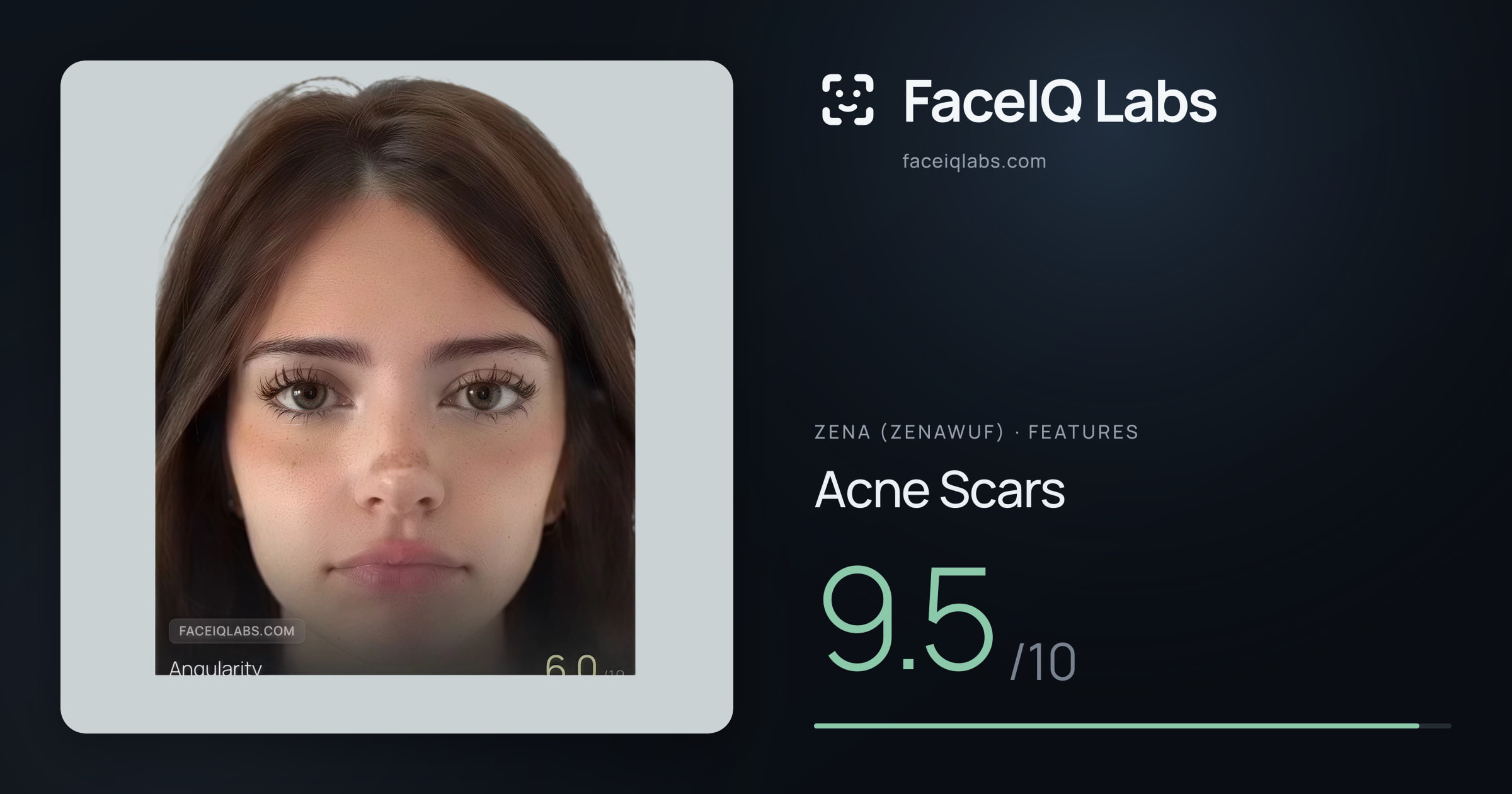 Zena (Zenawuf) Acne Scars: 9.5/10, drawn on the photo