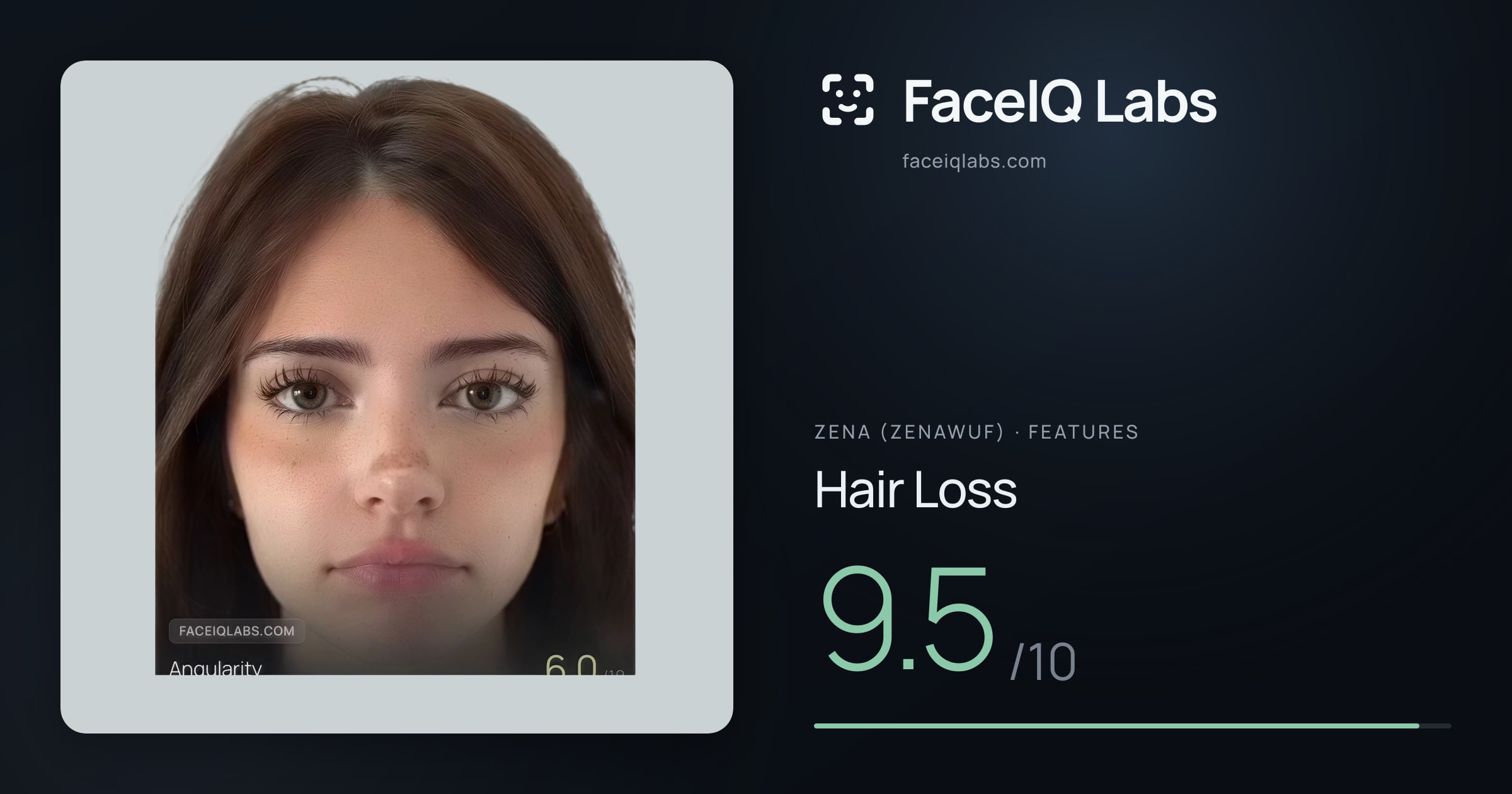 Zena (Zenawuf) Hair Loss: 9.5/10, drawn on the photo