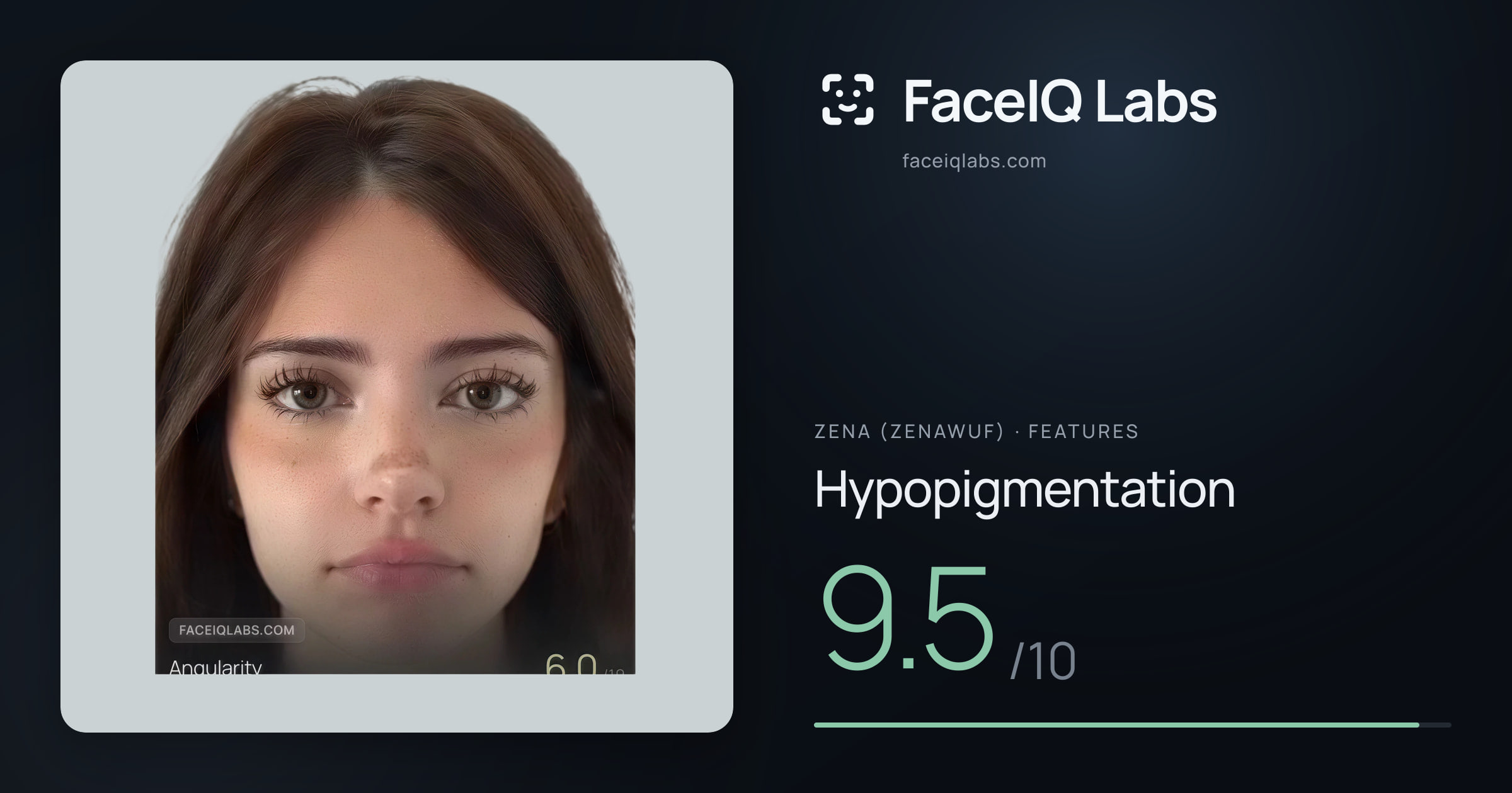 Zena (Zenawuf) Hypopigmentation: 9.5/10, drawn on the photo