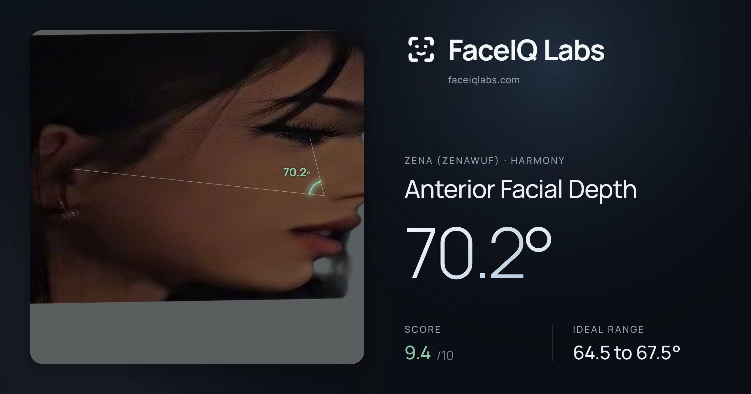 Zena (Zenawuf) Anterior Facial Depth: 70.2°, drawn on the photo