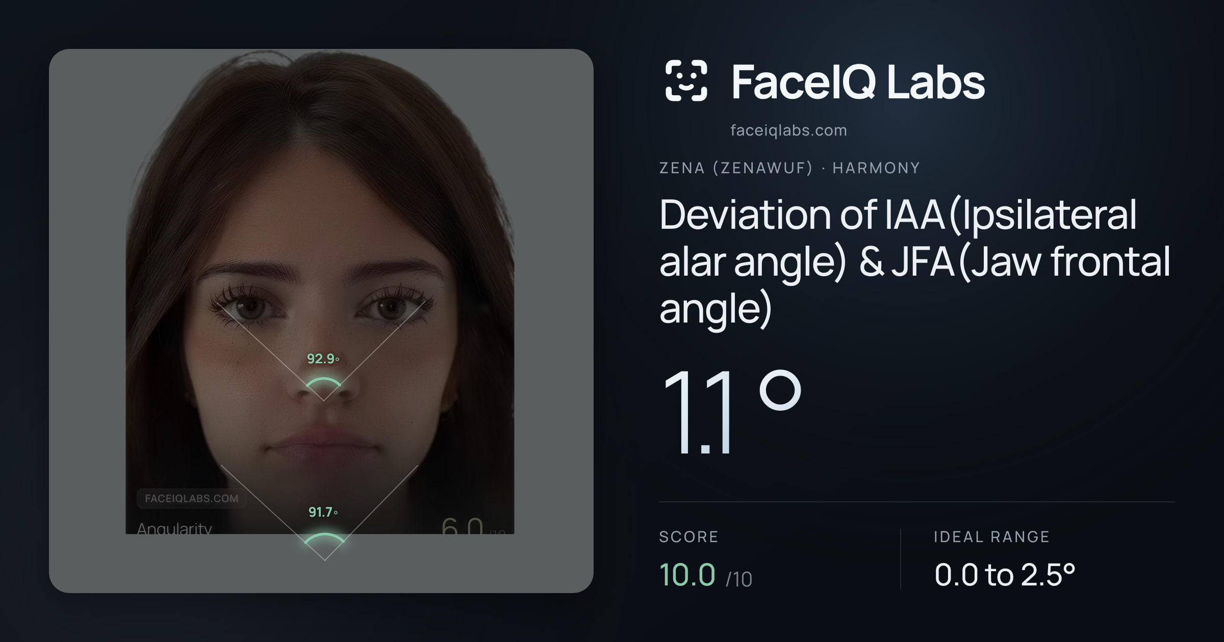 Zena (Zenawuf) Deviation of IAA(Ipsilateral alar angle) & JFA(Jaw frontal angle): 1.1°, drawn on the photo