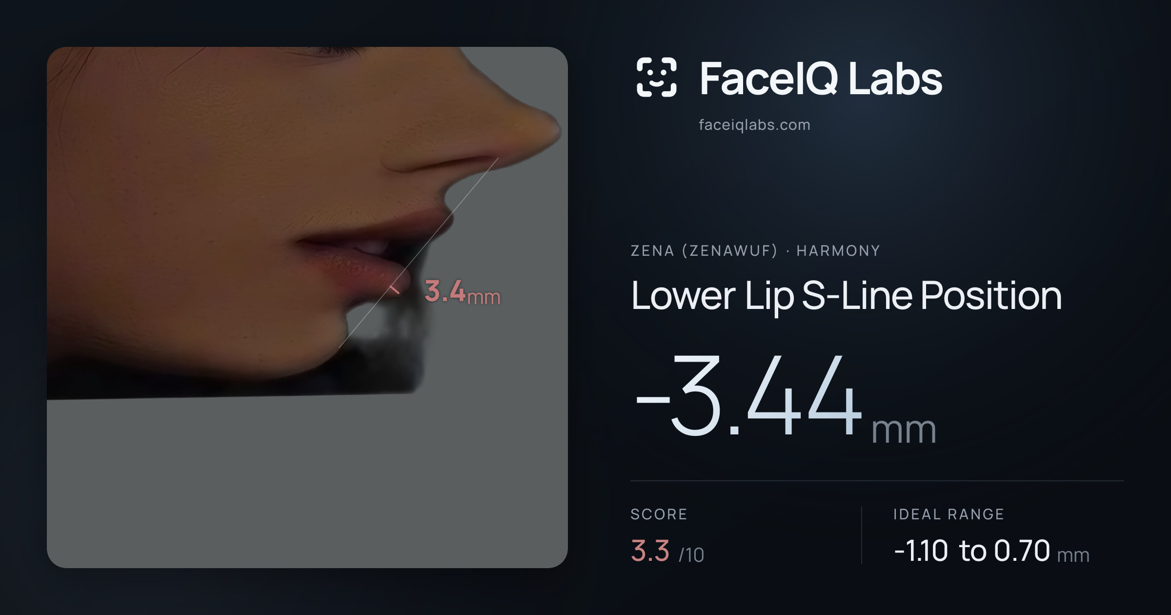 Zena (Zenawuf) Lower Lip S-Line Position: -3.44mm, drawn on the photo