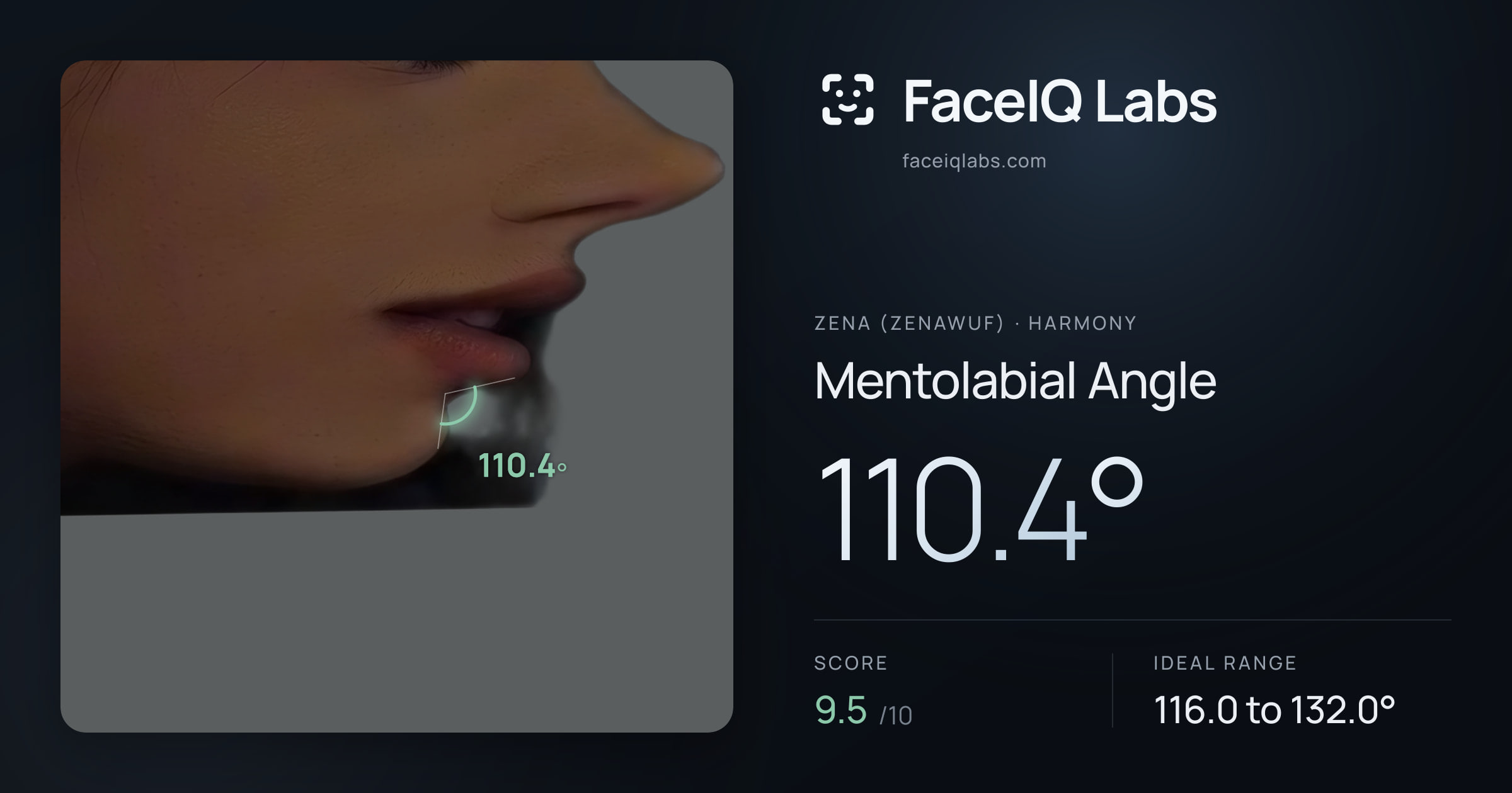 Zena (Zenawuf) Mentolabial Angle: 110.4°, drawn on the photo