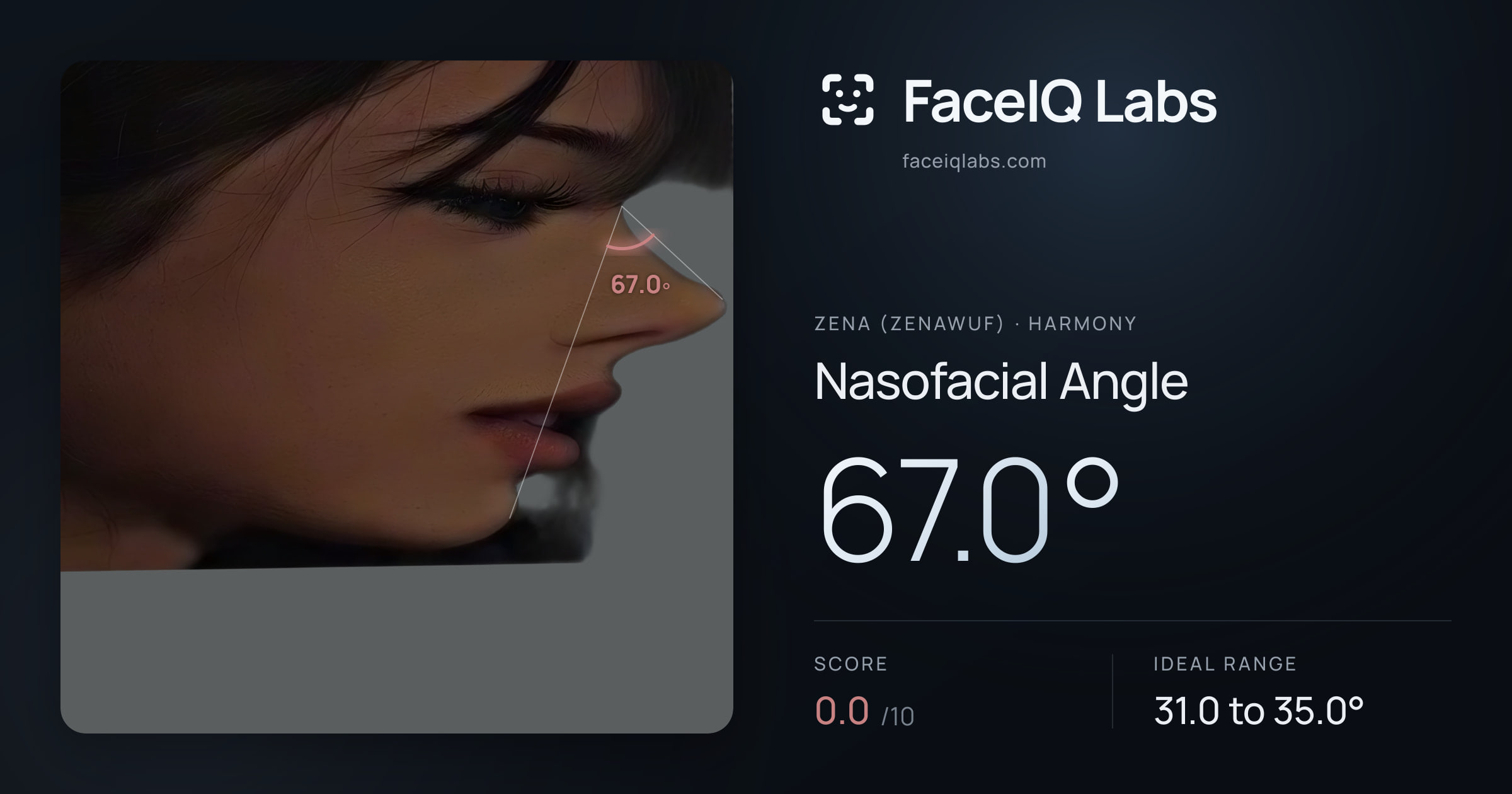 Zena (Zenawuf) Nasofacial Angle: 67.0°, drawn on the photo