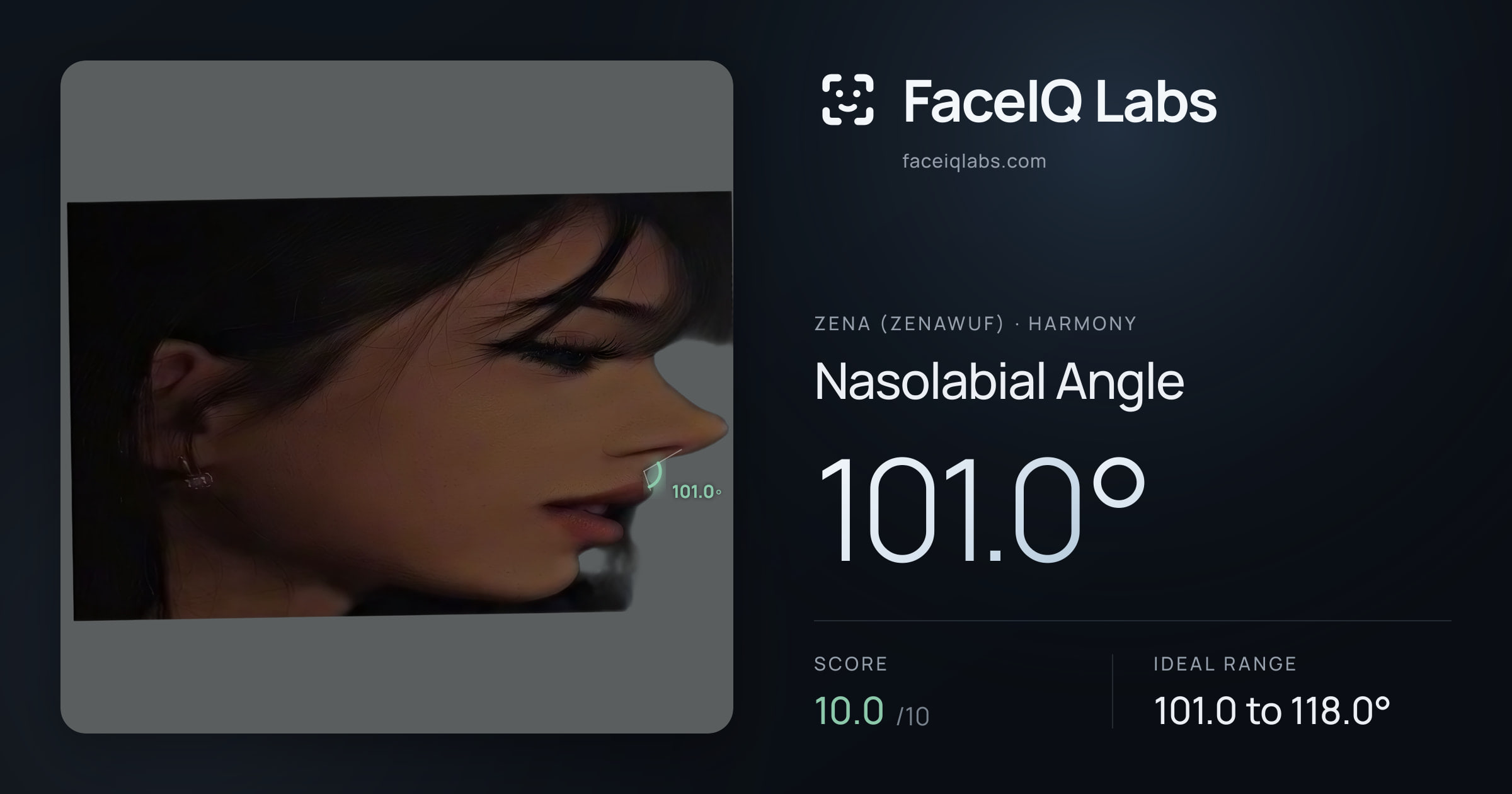 Zena (Zenawuf) Nasolabial Angle: 101.0°, drawn on the photo