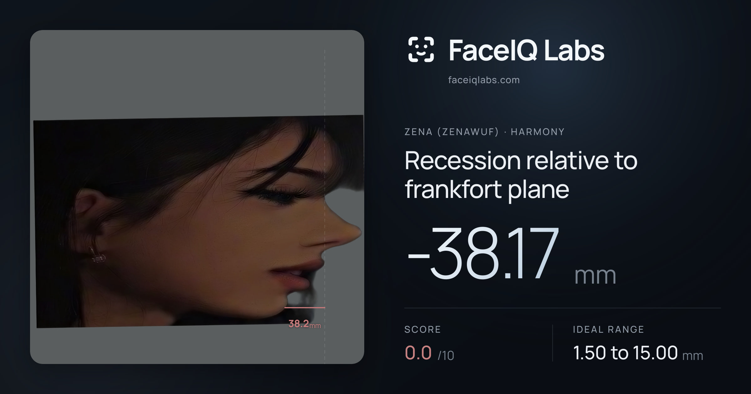 Zena (Zenawuf) Recession relative to frankfort plane: -38.17mm, drawn on the photo