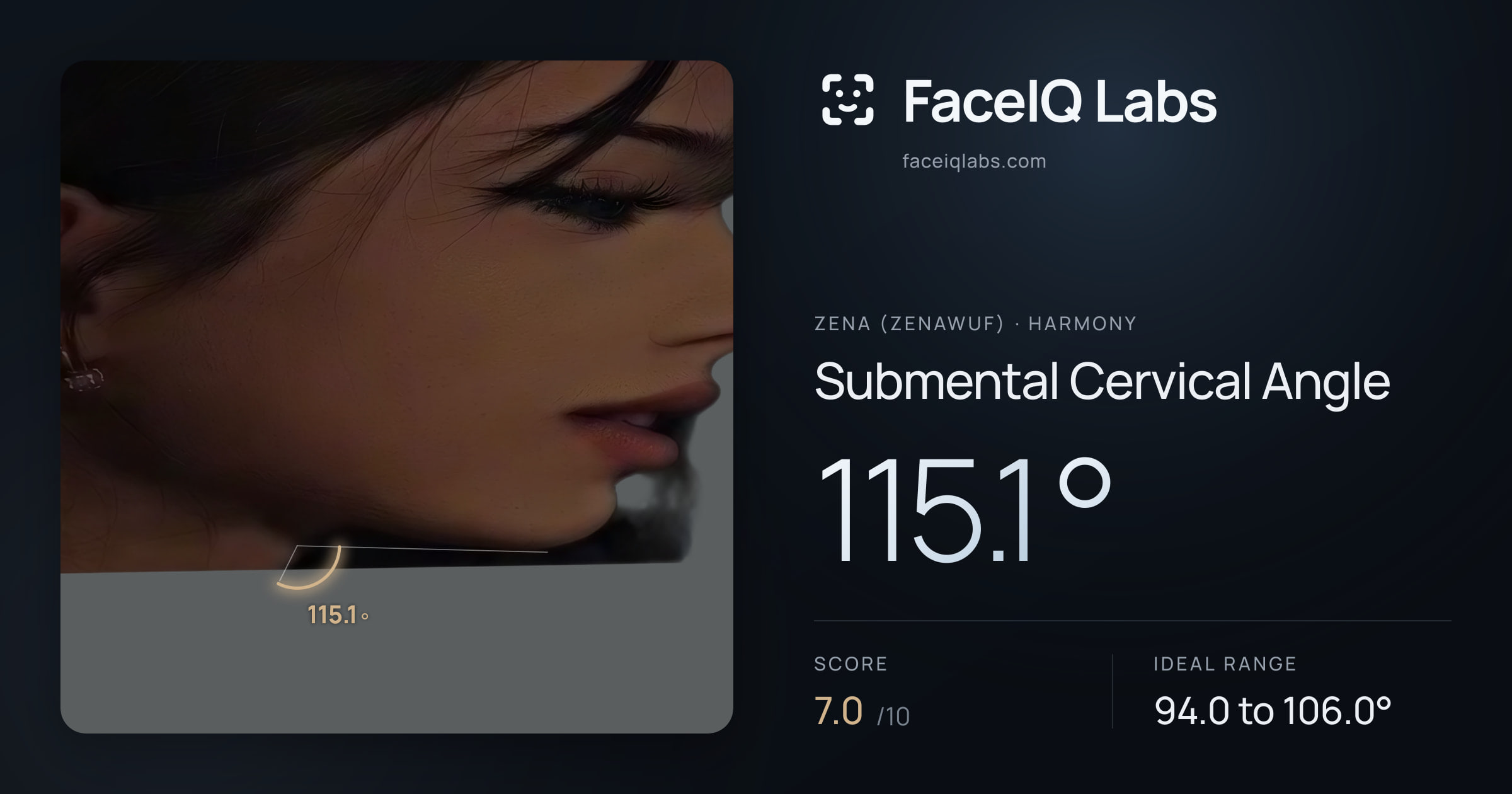 Zena (Zenawuf) Submental Cervical Angle: 115.1°, drawn on the photo