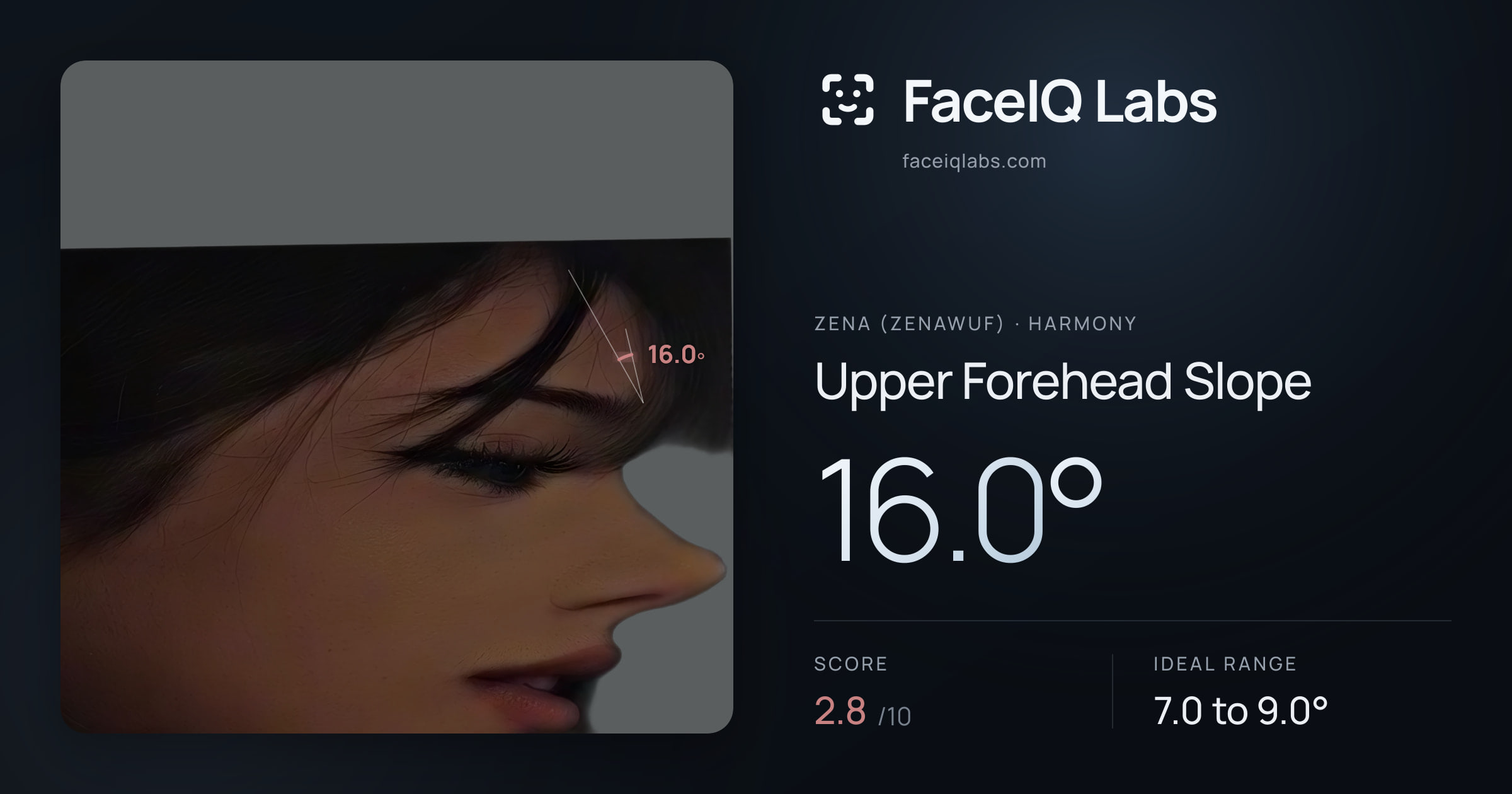 Zena (Zenawuf) Upper Forehead Slope: 16.0°, drawn on the photo
