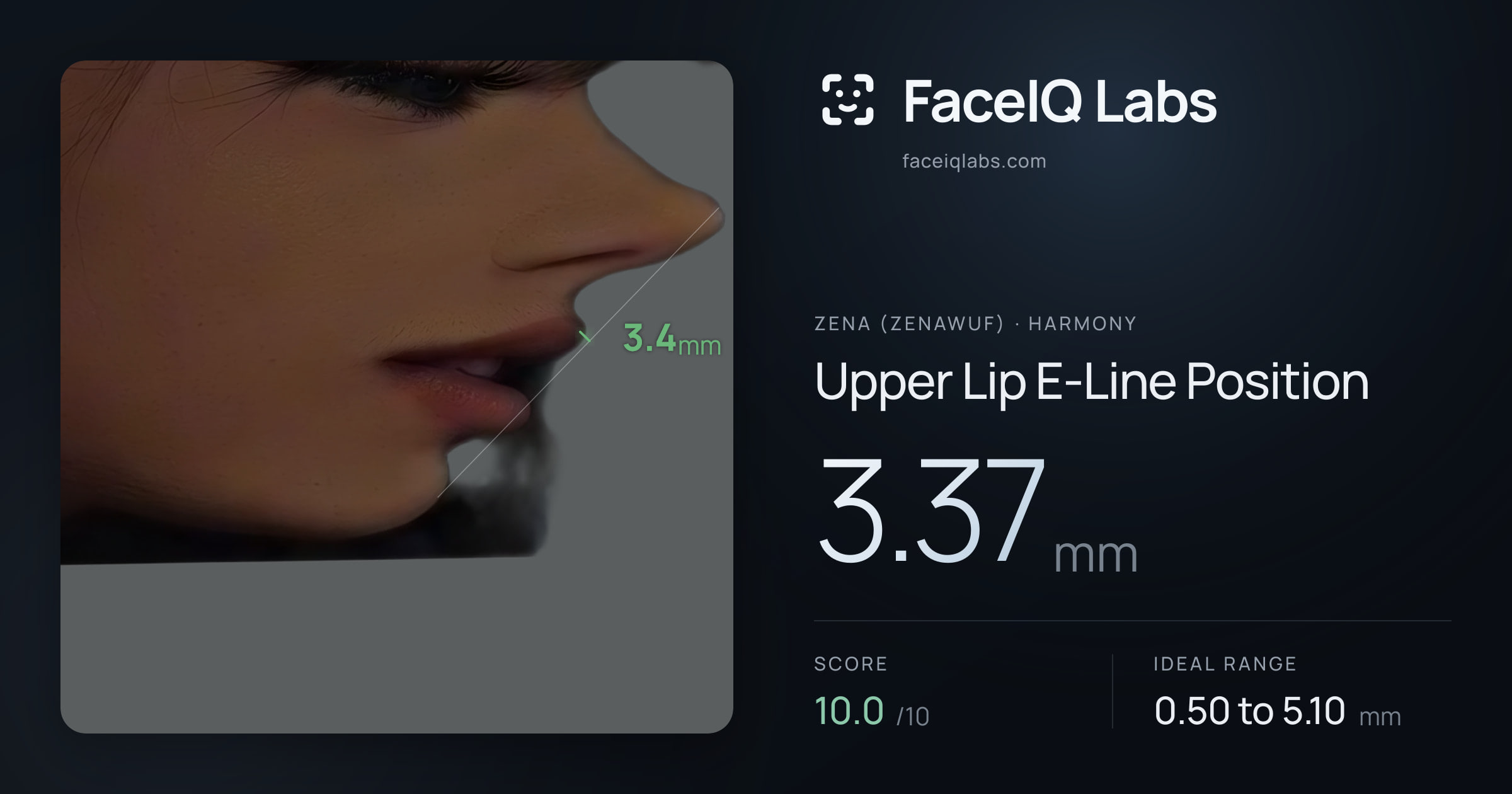 Zena (Zenawuf) Upper Lip E-Line Position: 3.37mm, drawn on the photo