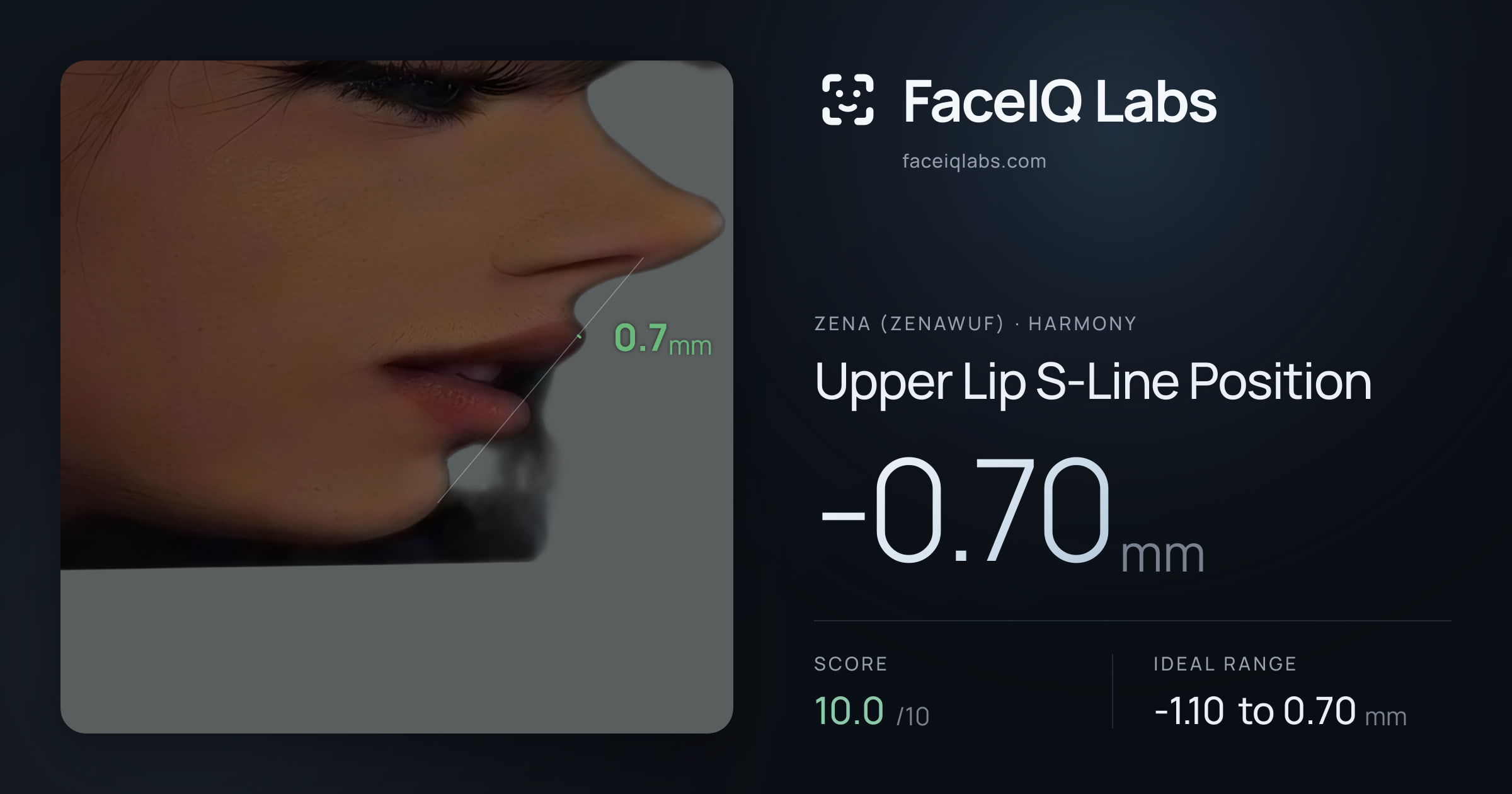 Zena (Zenawuf) Upper Lip S-Line Position: -0.70mm, drawn on the photo