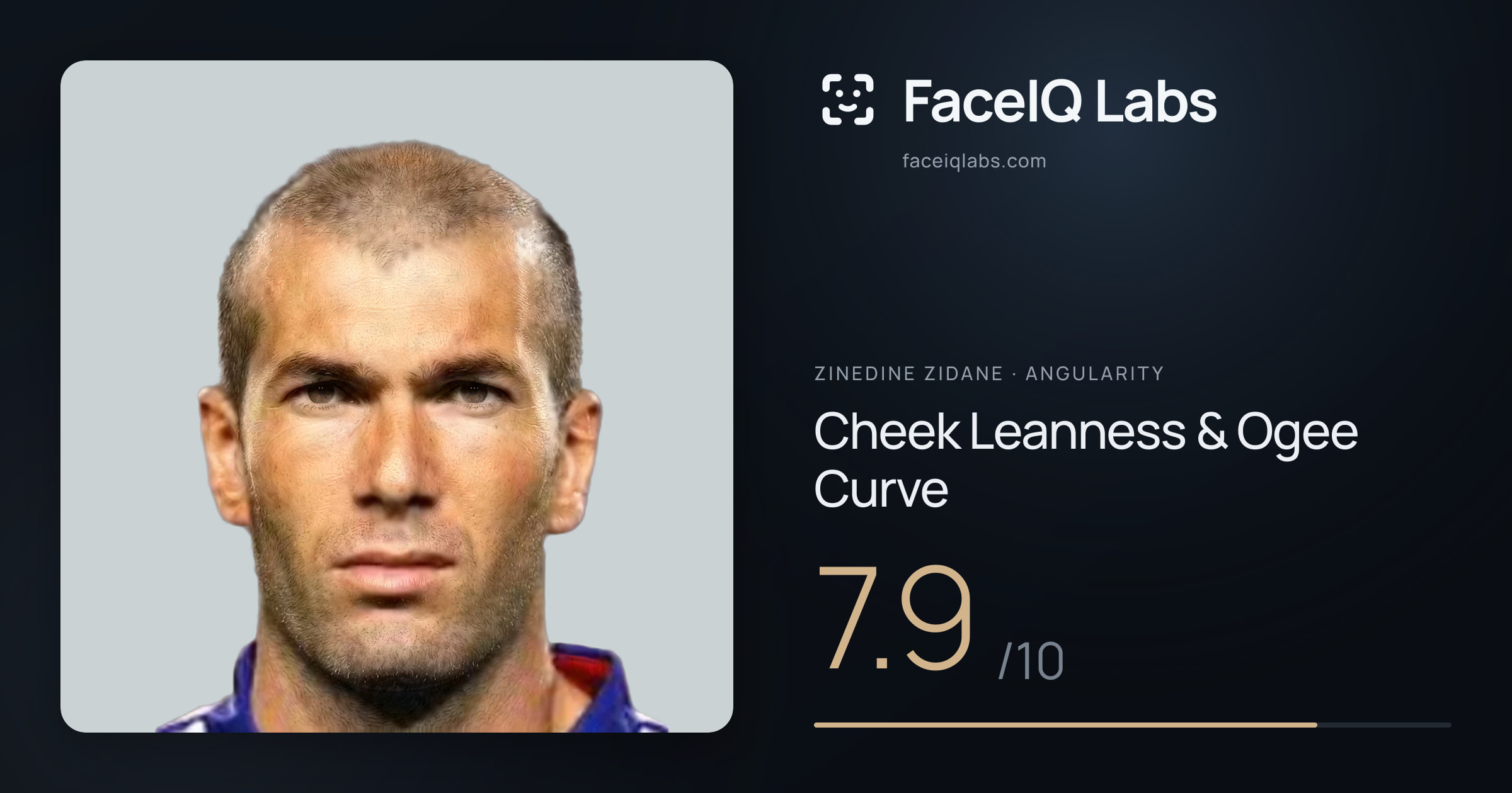 Zinedine Zidane Cheek Leanness & Ogee Curve: 7.9/10, drawn on the photo