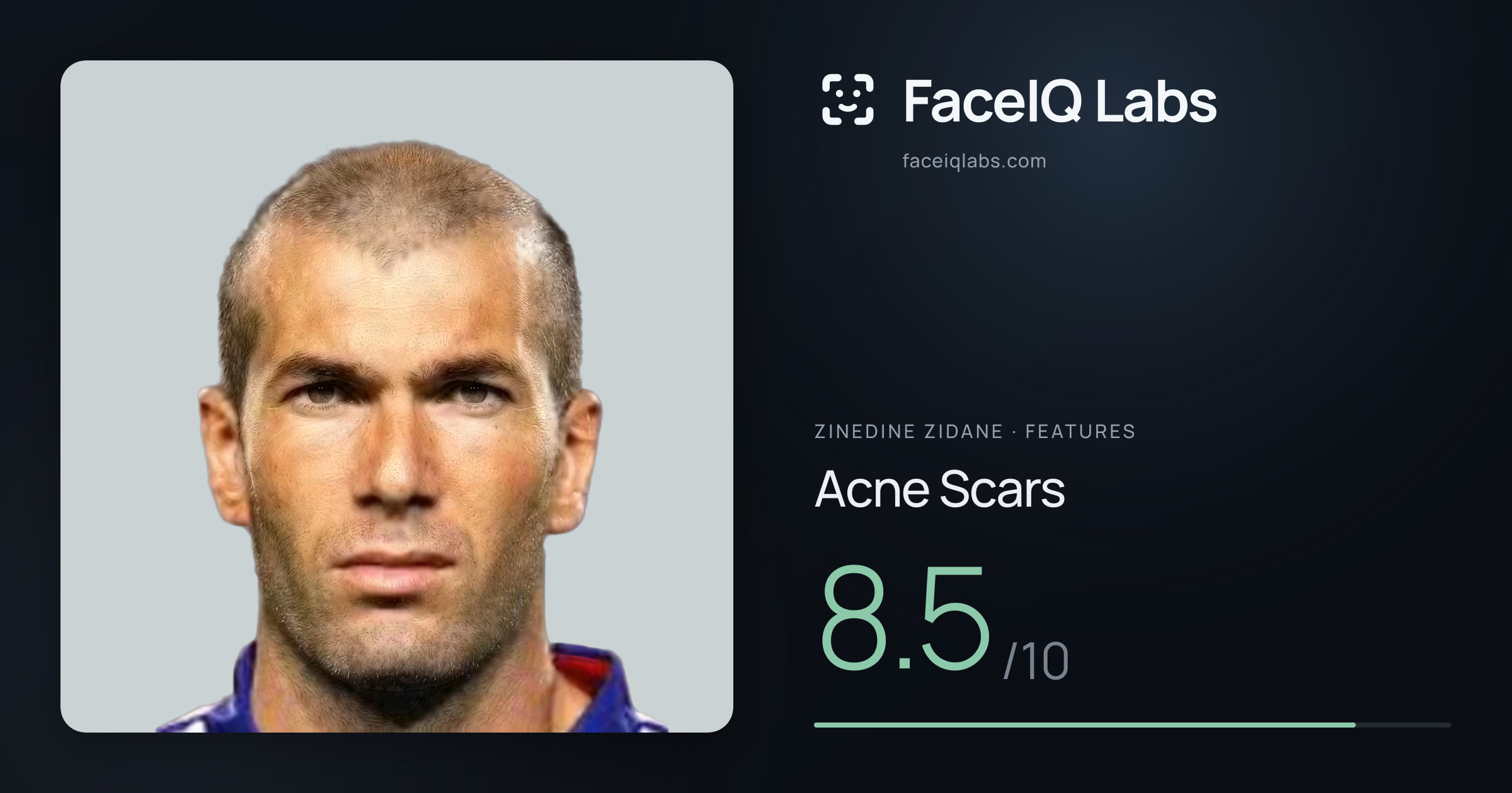 Zinedine Zidane Acne Scars: 8.5/10, drawn on the photo