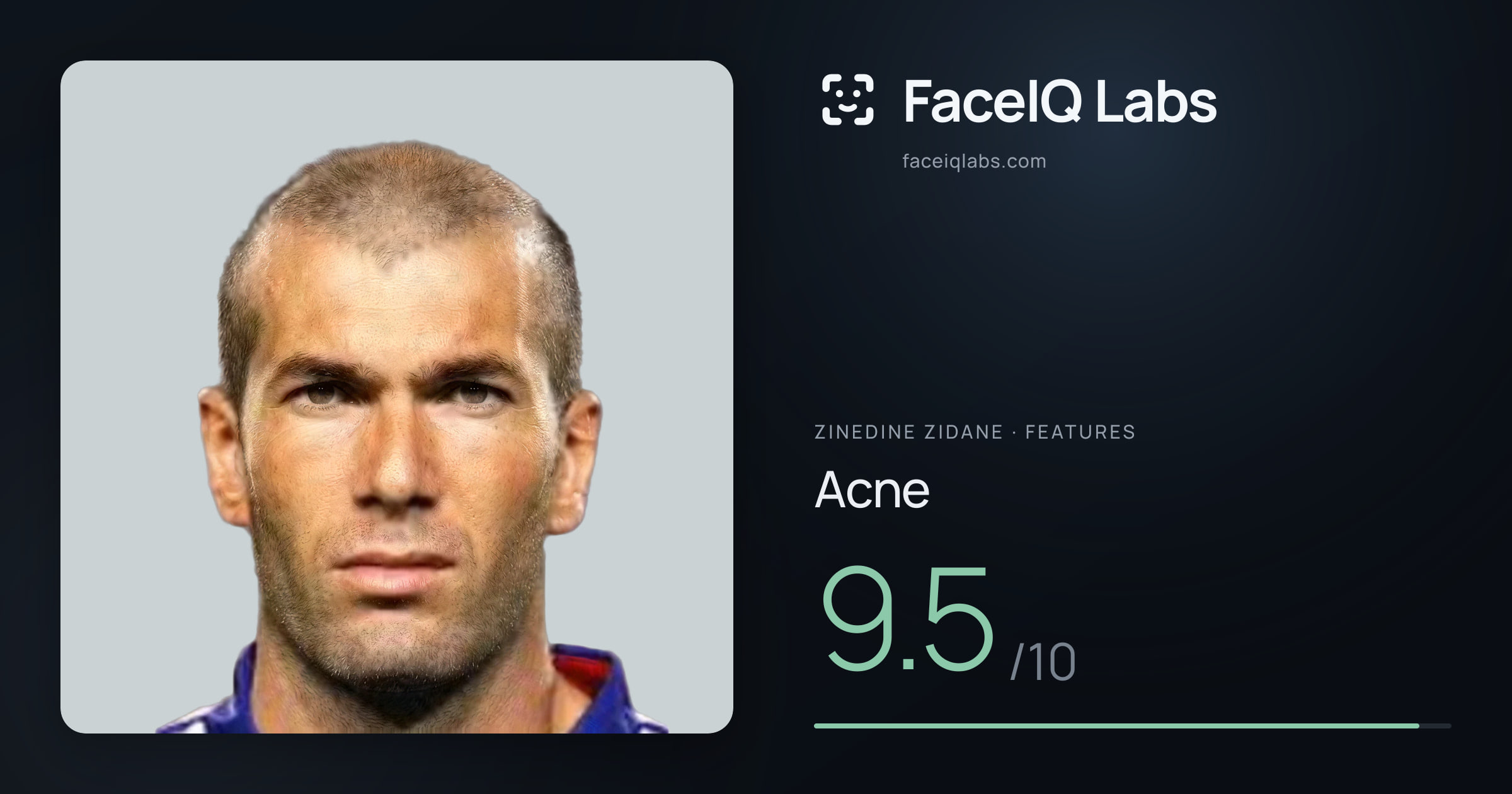 Zinedine Zidane Acne: 9.5/10, drawn on the photo