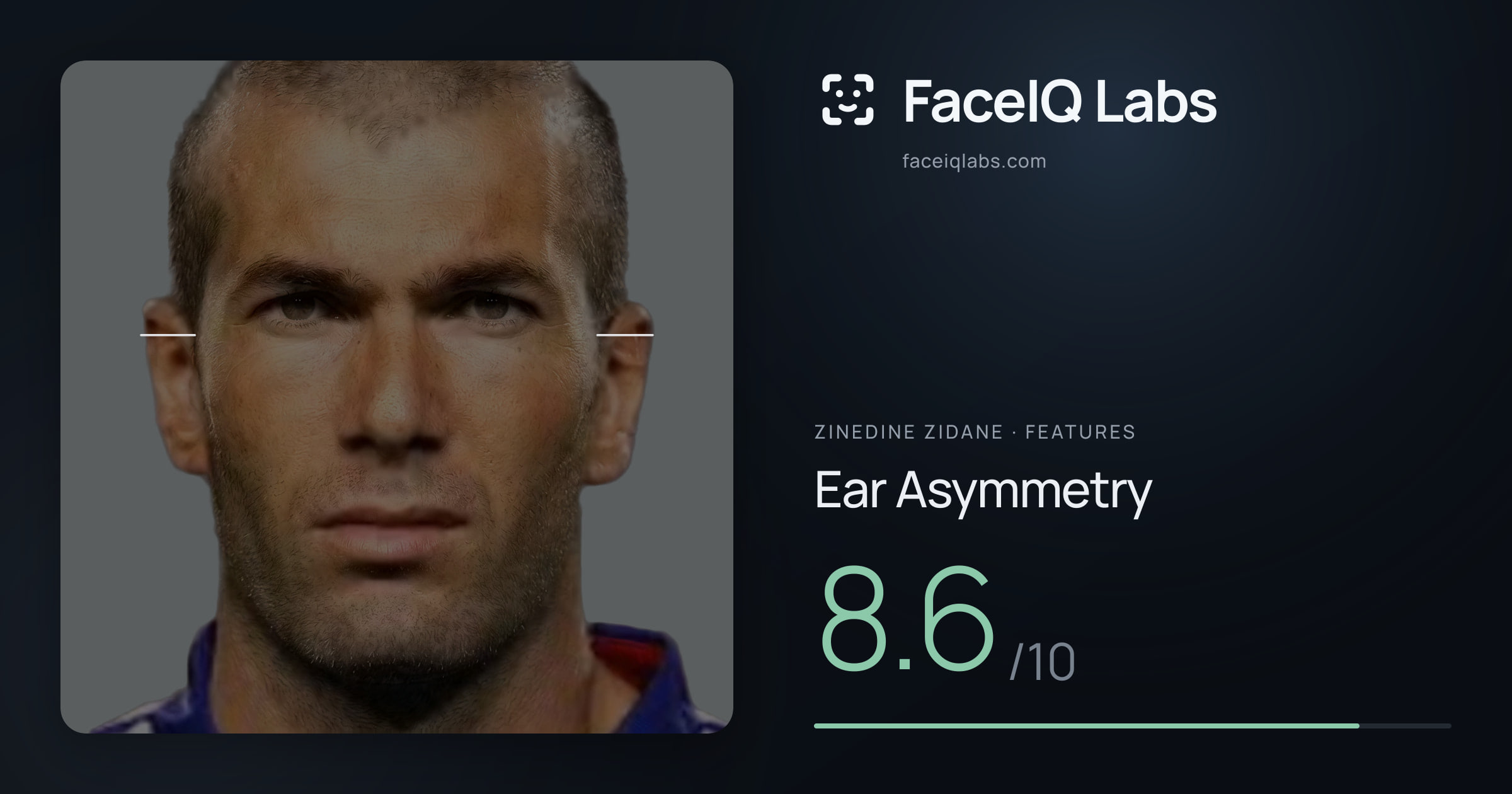 Zinedine Zidane Ear Asymmetry: 8.6/10, drawn on the photo