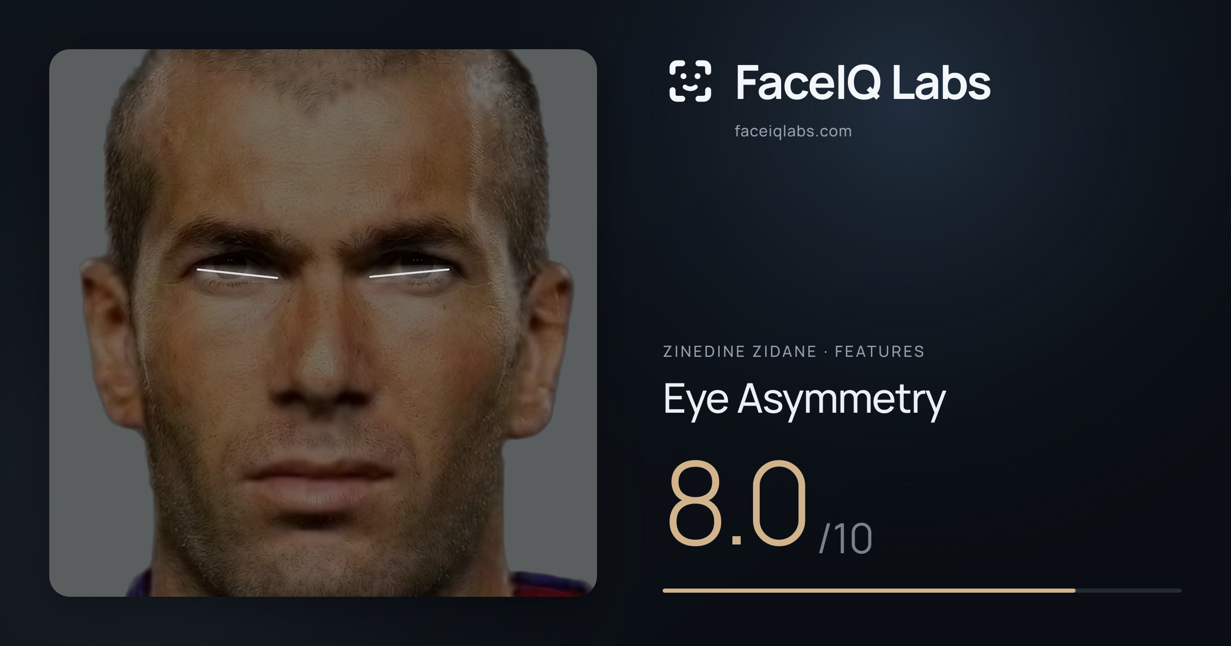Zinedine Zidane Eye Asymmetry: 8.0/10, drawn on the photo