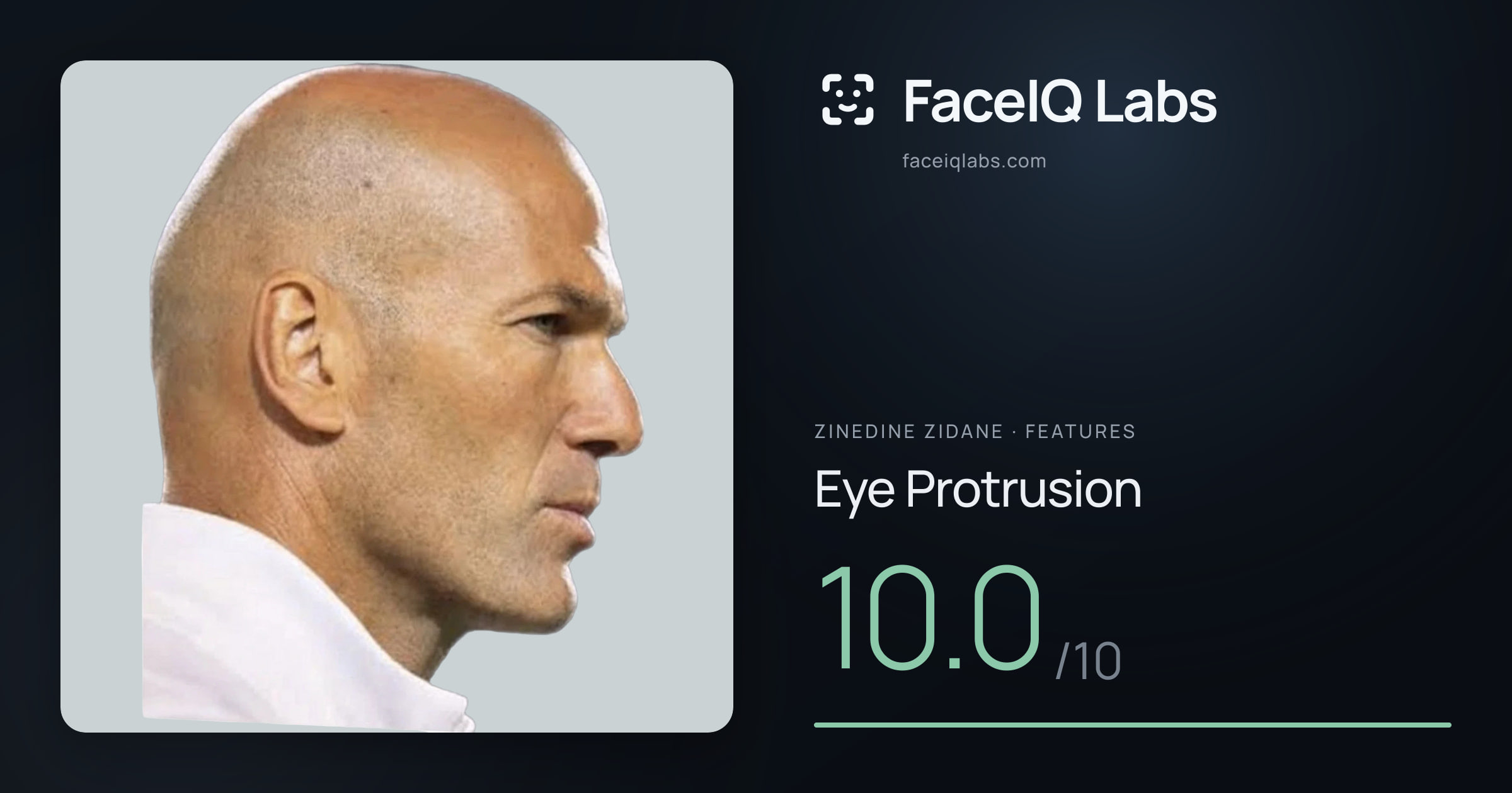 Zinedine Zidane Eye Protrusion: 10.0/10, drawn on the photo