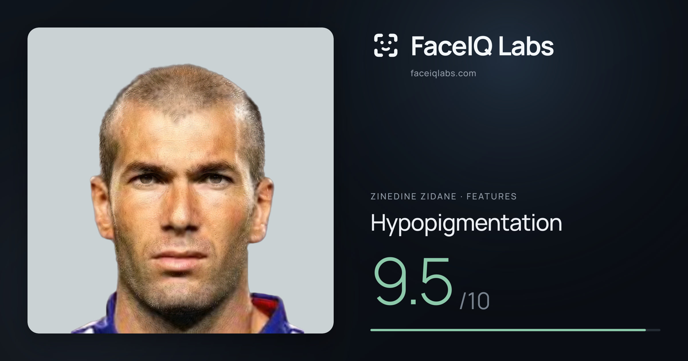 Zinedine Zidane Hypopigmentation: 9.5/10, drawn on the photo