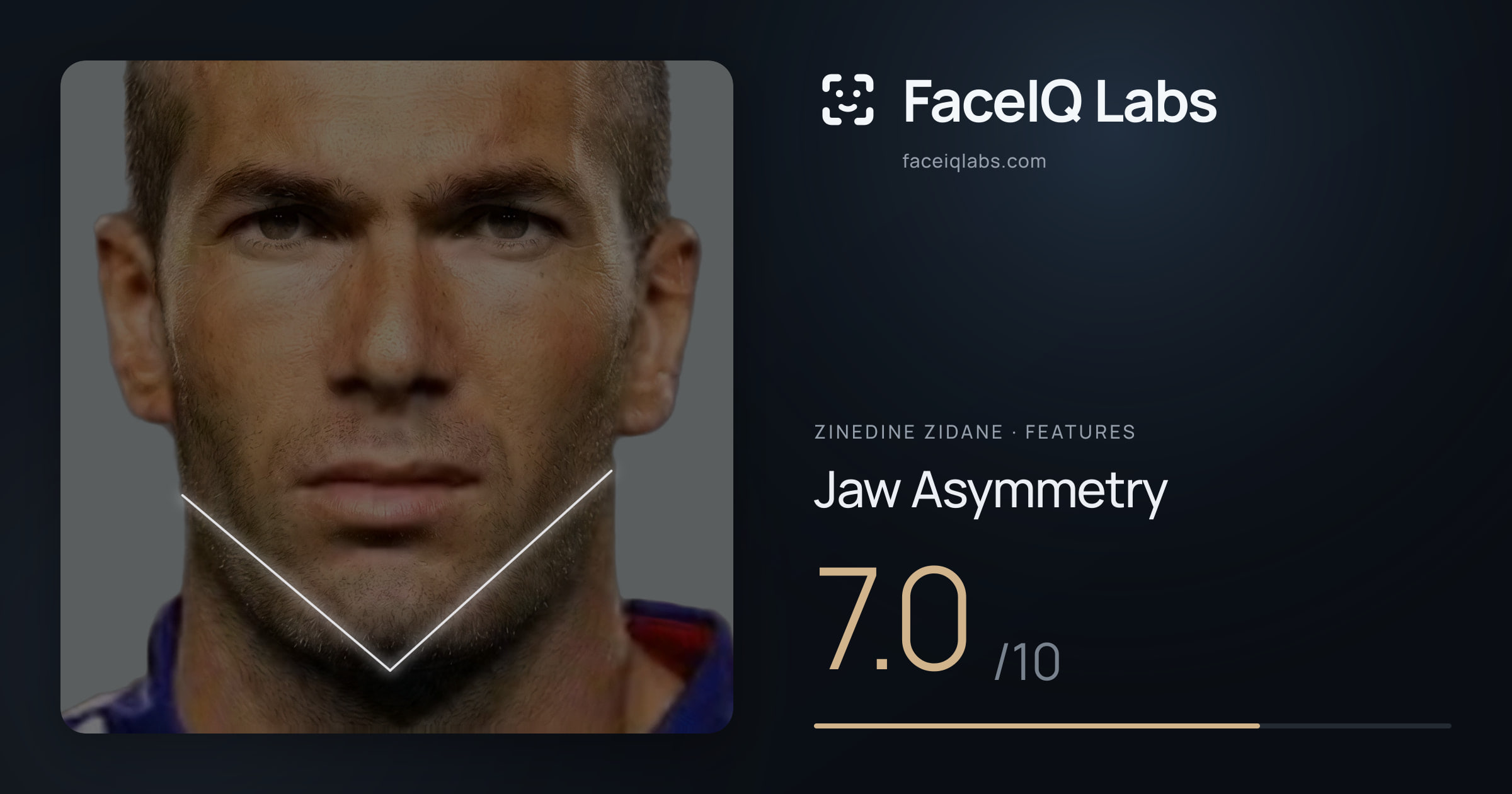 Zinedine Zidane Jaw Asymmetry: 7.0/10, drawn on the photo