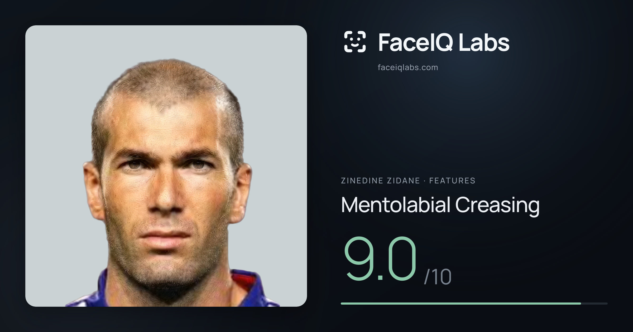 Zinedine Zidane Mentolabial Creasing: 9.0/10, drawn on the photo