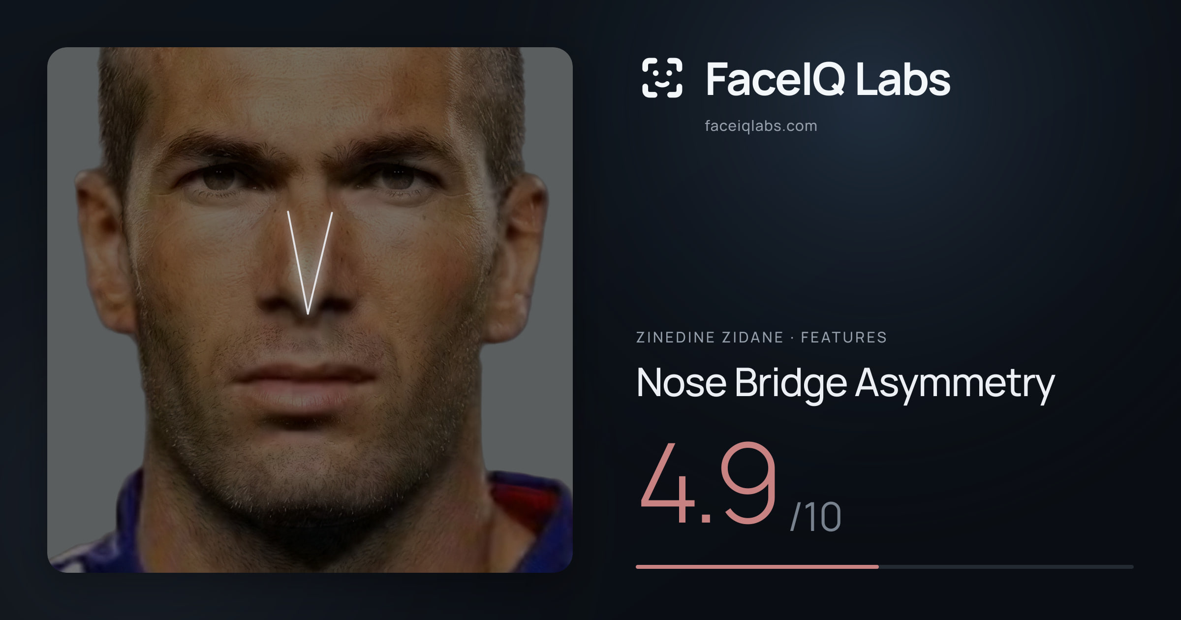 Zinedine Zidane Nose Bridge Asymmetry: 4.9/10, drawn on the photo
