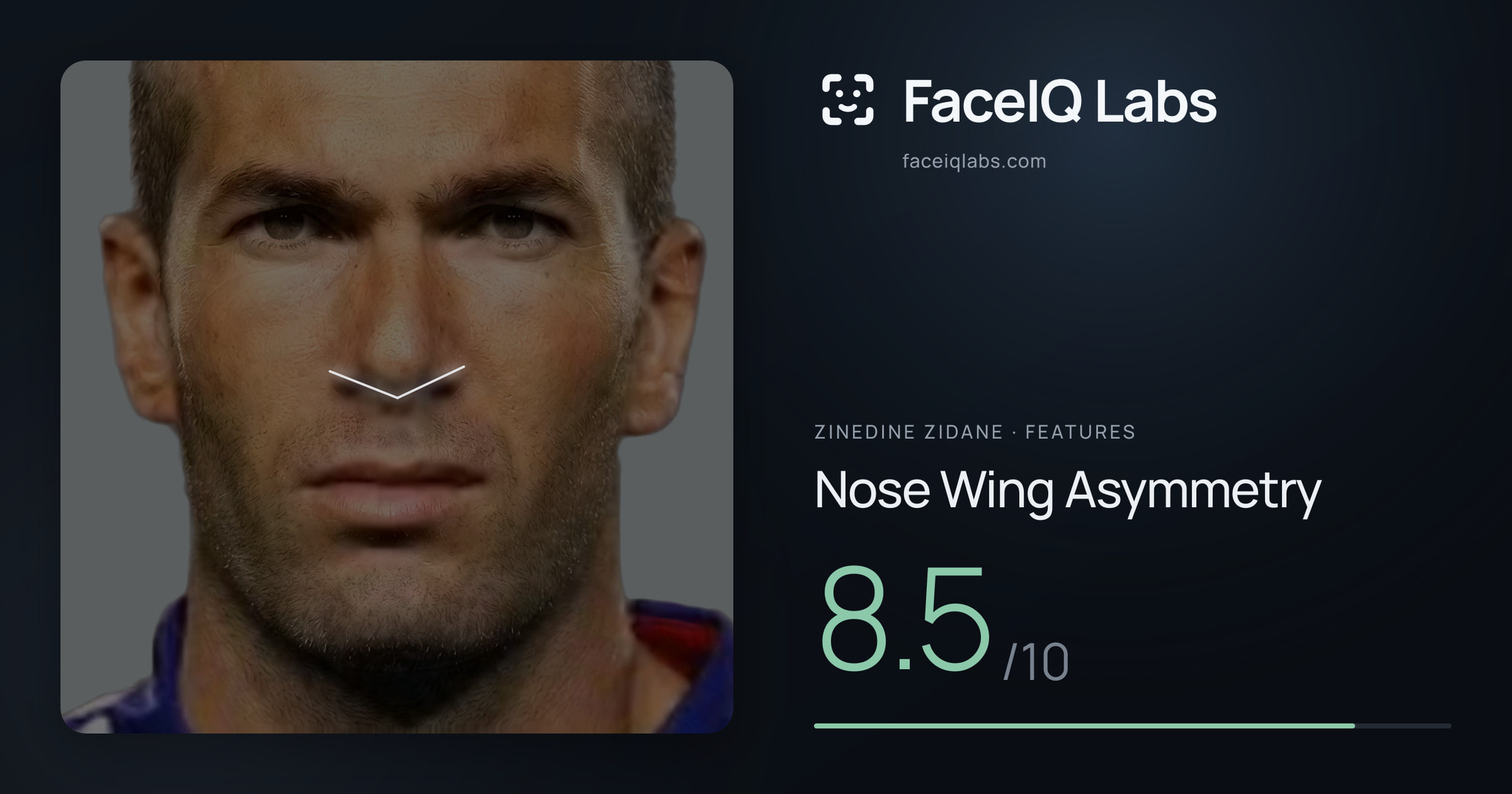 Zinedine Zidane Nose Wing Asymmetry: 8.5/10, drawn on the photo