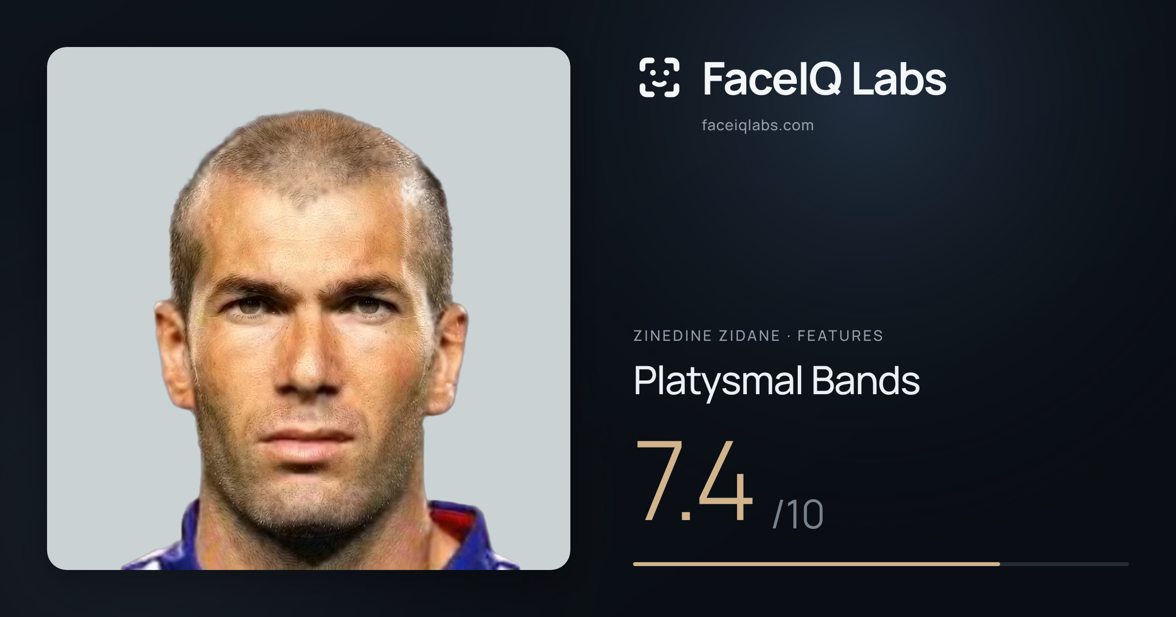 Zinedine Zidane Platysmal Bands: 7.4/10, drawn on the photo