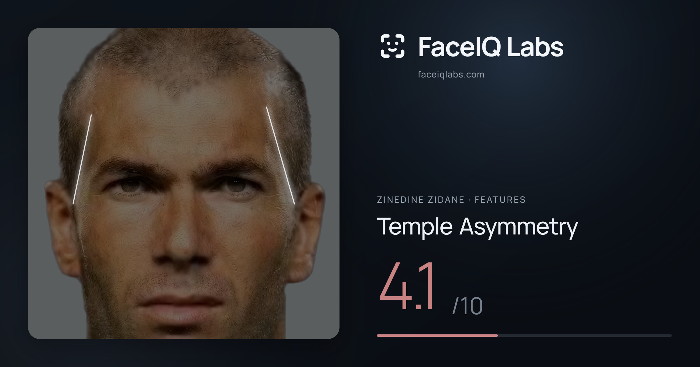 Zinedine Zidane Temple Asymmetry: 4.1/10, drawn on the photo