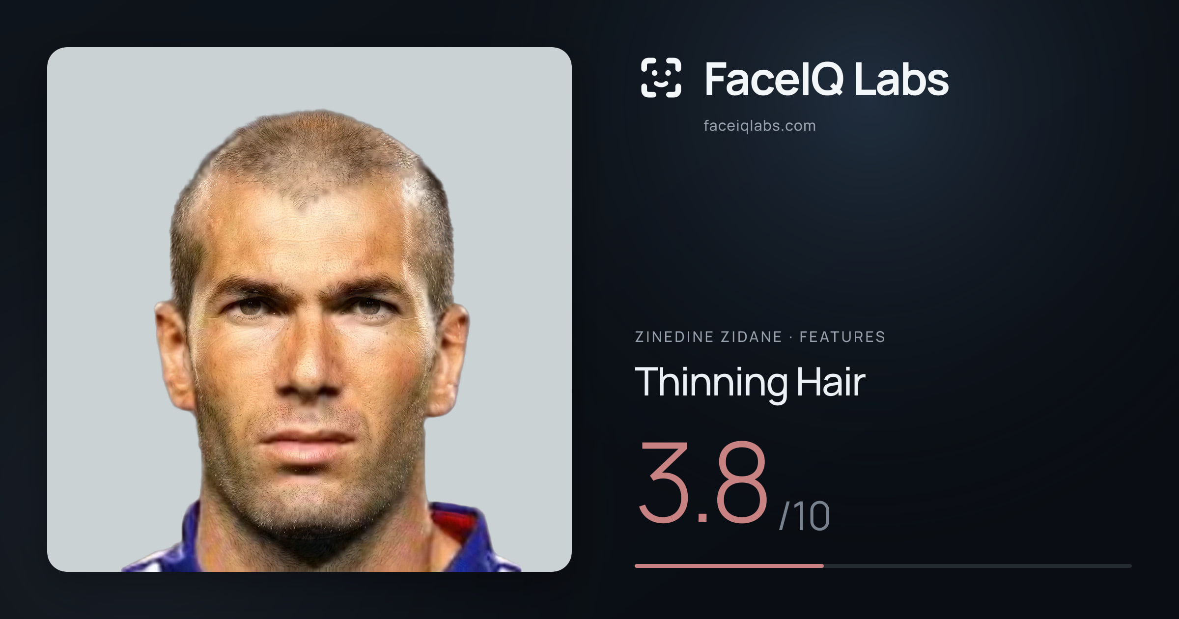 Zinedine Zidane Thinning Hair: 3.8/10, drawn on the photo