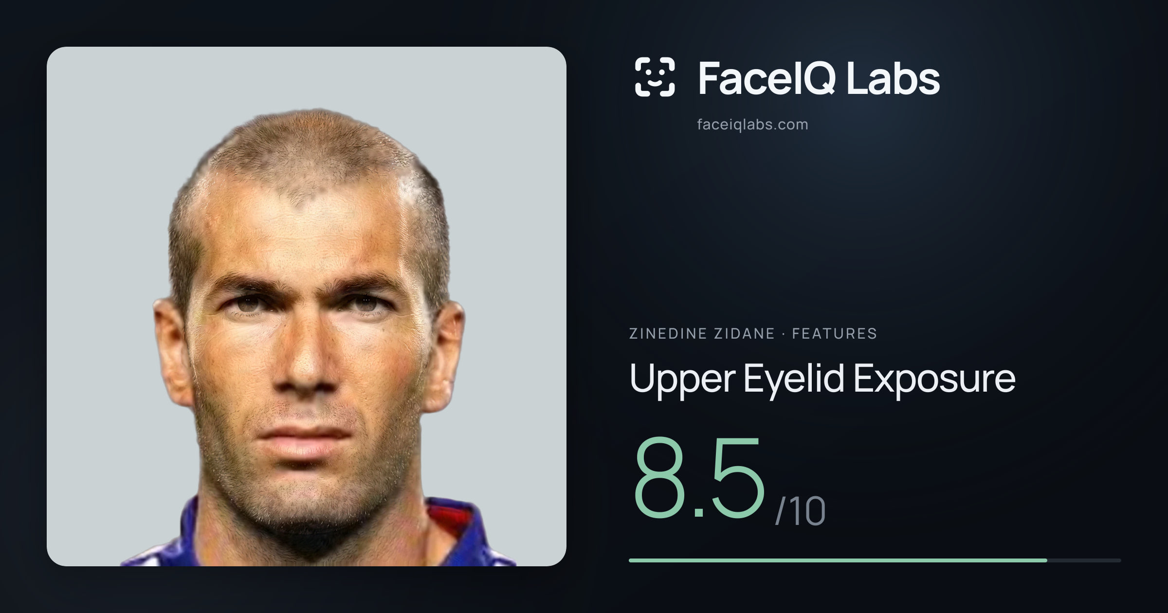 Zinedine Zidane Upper Eyelid Exposure: 8.5/10, drawn on the photo