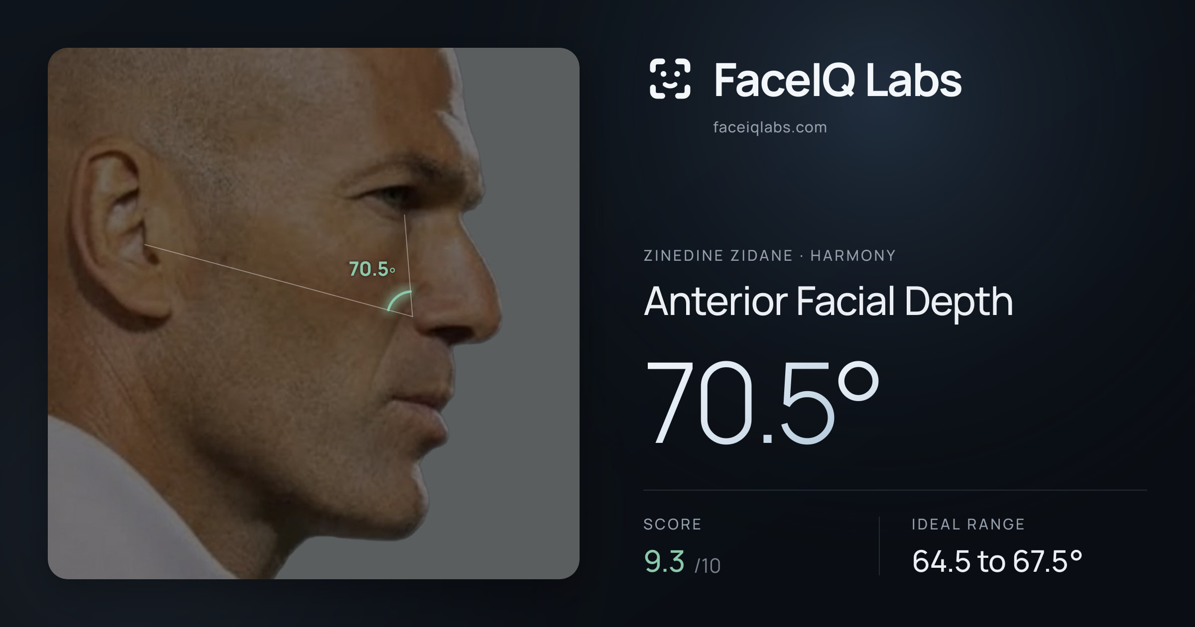 Zinedine Zidane Anterior Facial Depth: 70.5°, drawn on the photo