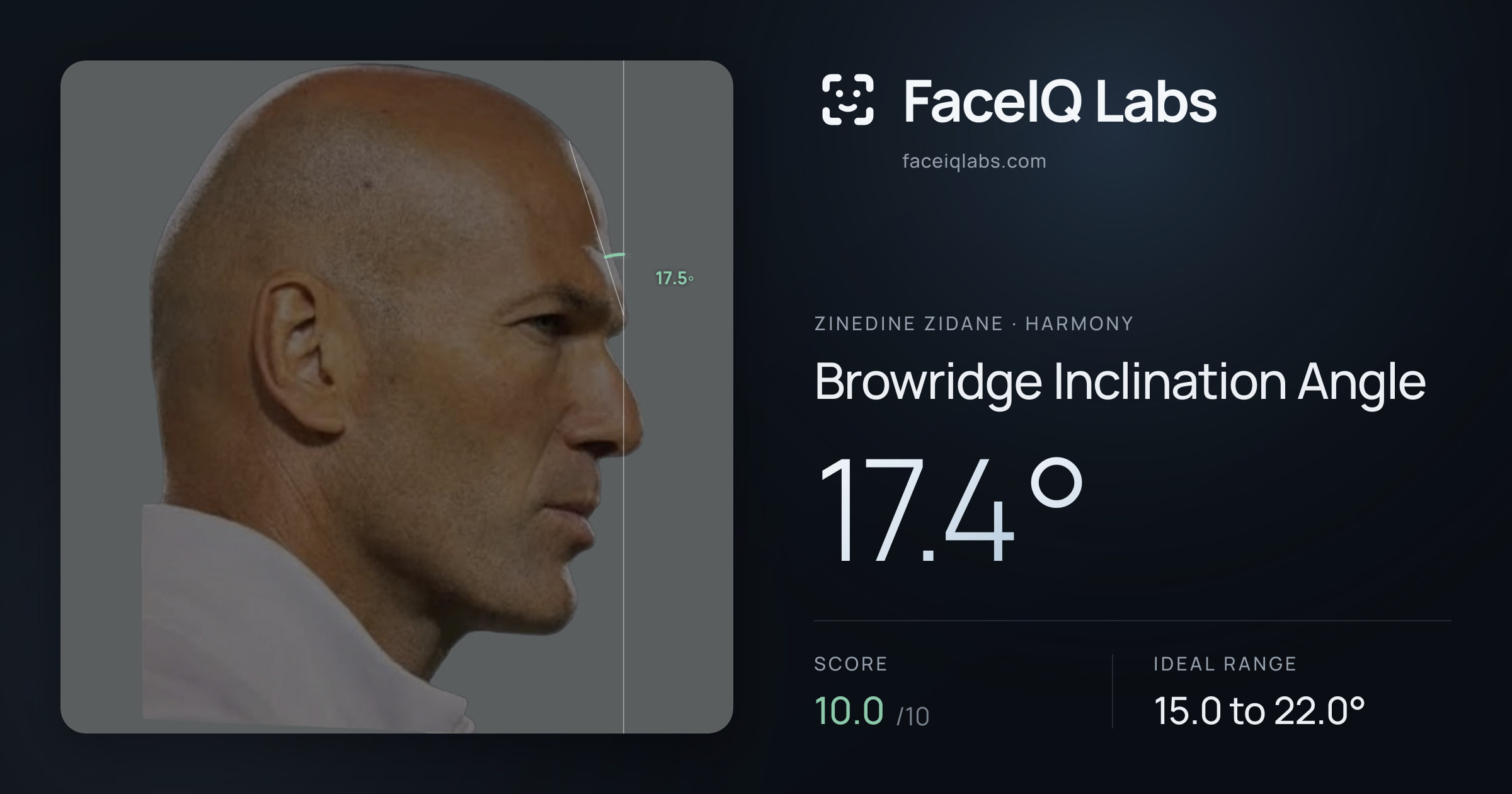 Zinedine Zidane Browridge Inclination Angle: 17.4°, drawn on the photo