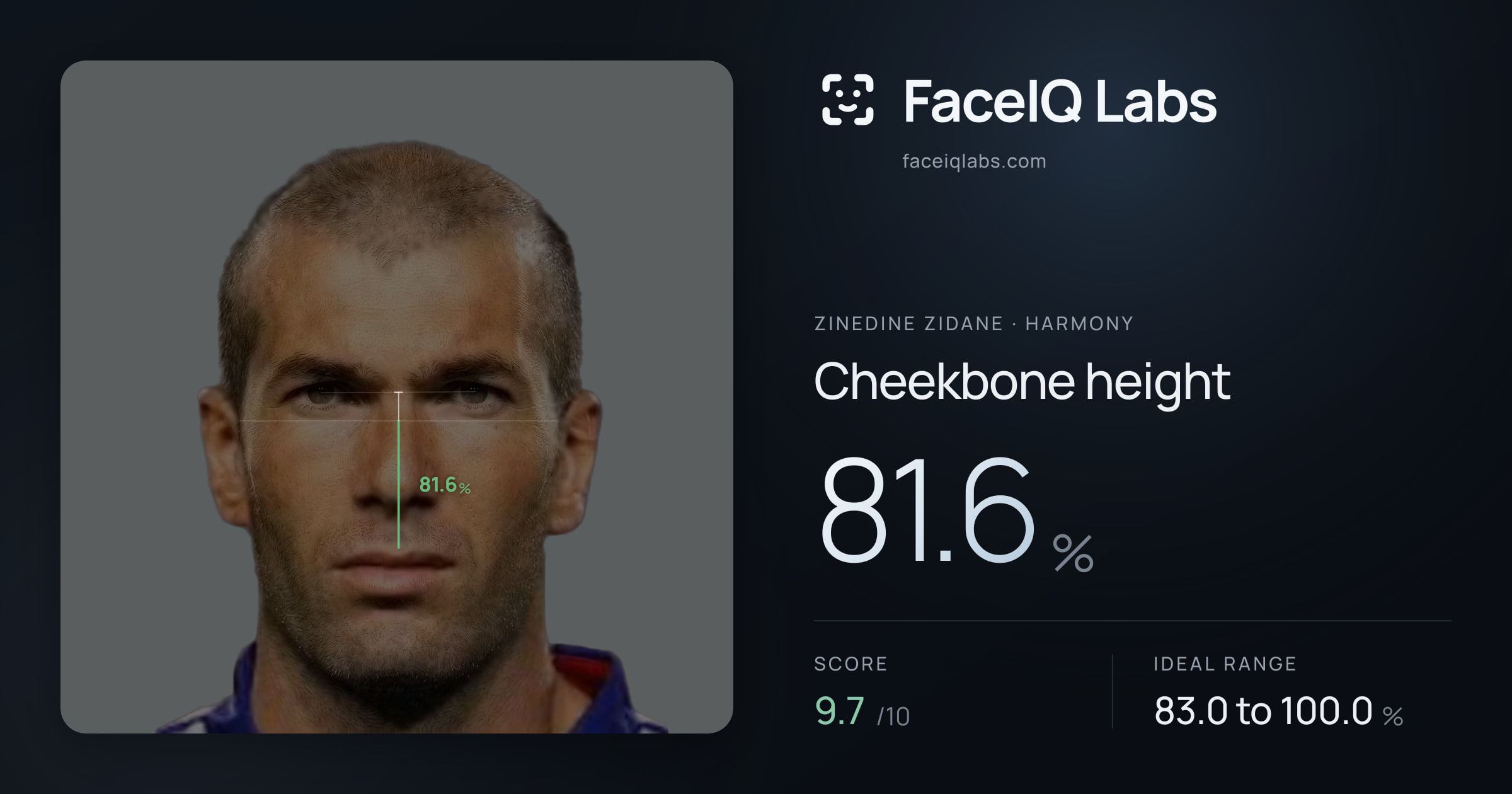 Zinedine Zidane Cheekbone height: 81.6%, drawn on the photo
