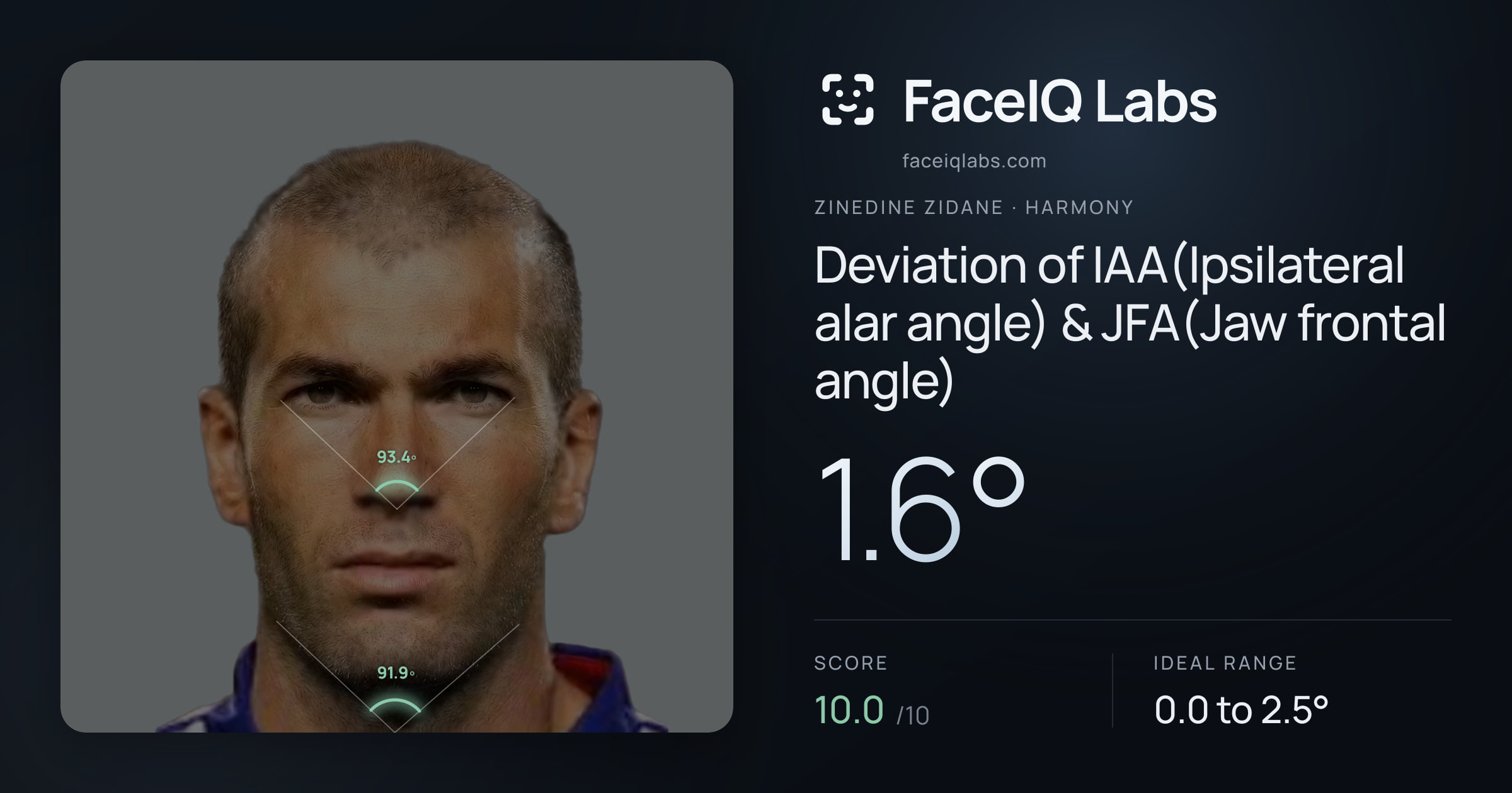 Zinedine Zidane Deviation of IAA(Ipsilateral alar angle) & JFA(Jaw frontal angle): 1.6°, drawn on the photo