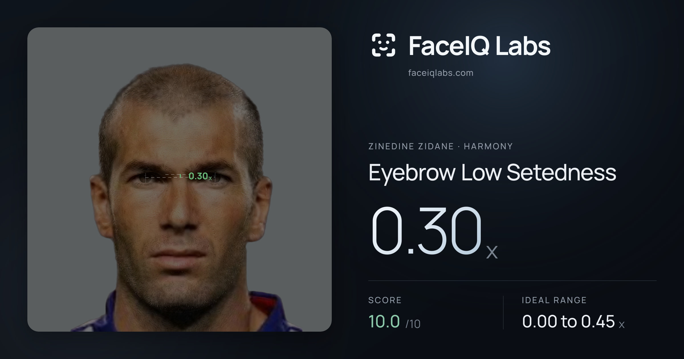 Zinedine Zidane Eyebrow Low Setedness: 0.30x, drawn on the photo