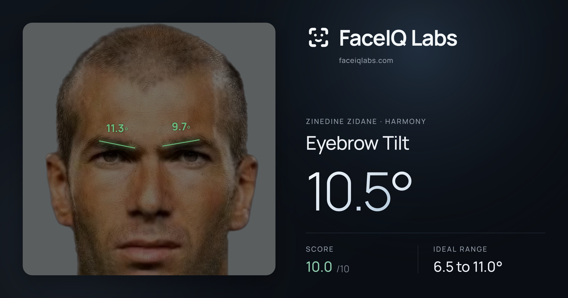 Zinedine Zidane Eyebrow Tilt: 10.5°, drawn on the photo