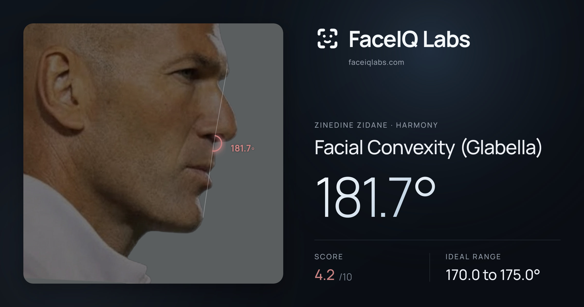 Zinedine Zidane Facial Convexity (Glabella): 181.7°, drawn on the photo