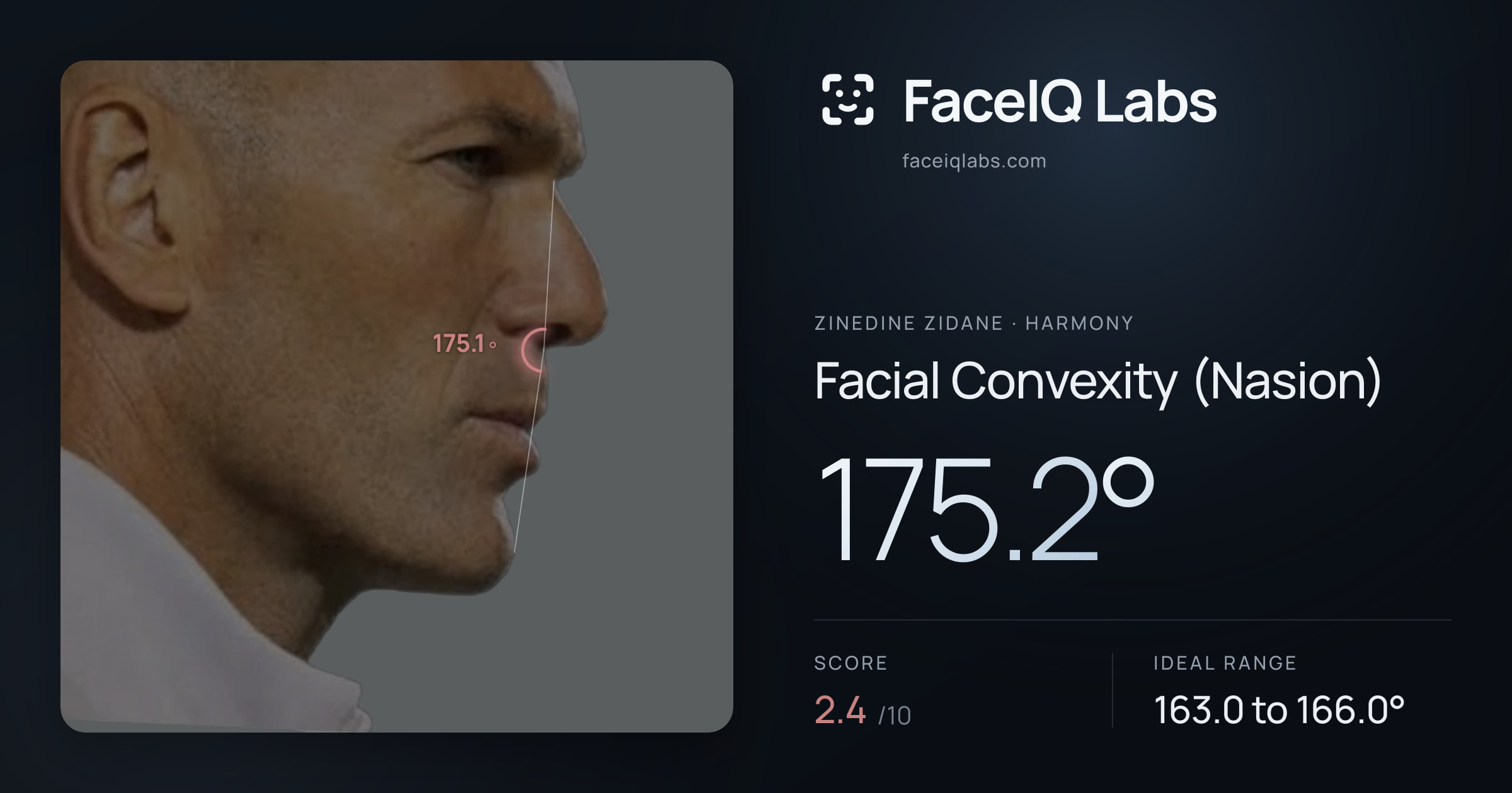 Zinedine Zidane Facial Convexity (Nasion): 175.2°, drawn on the photo