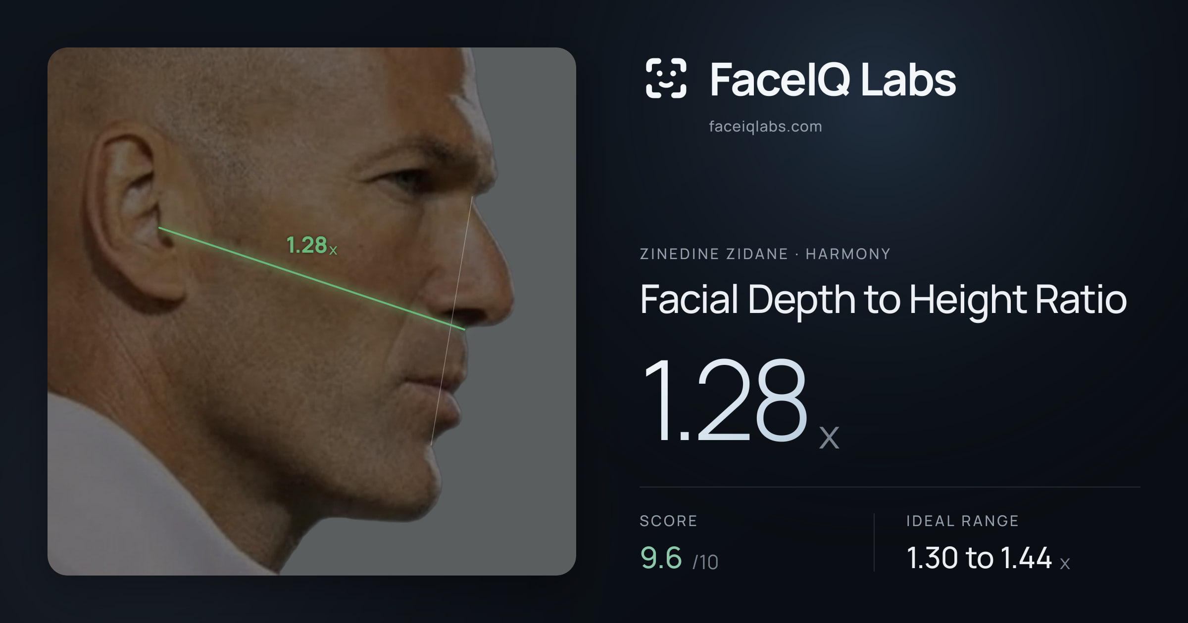 Zinedine Zidane Facial Depth to Height Ratio: 1.28x, drawn on the photo
