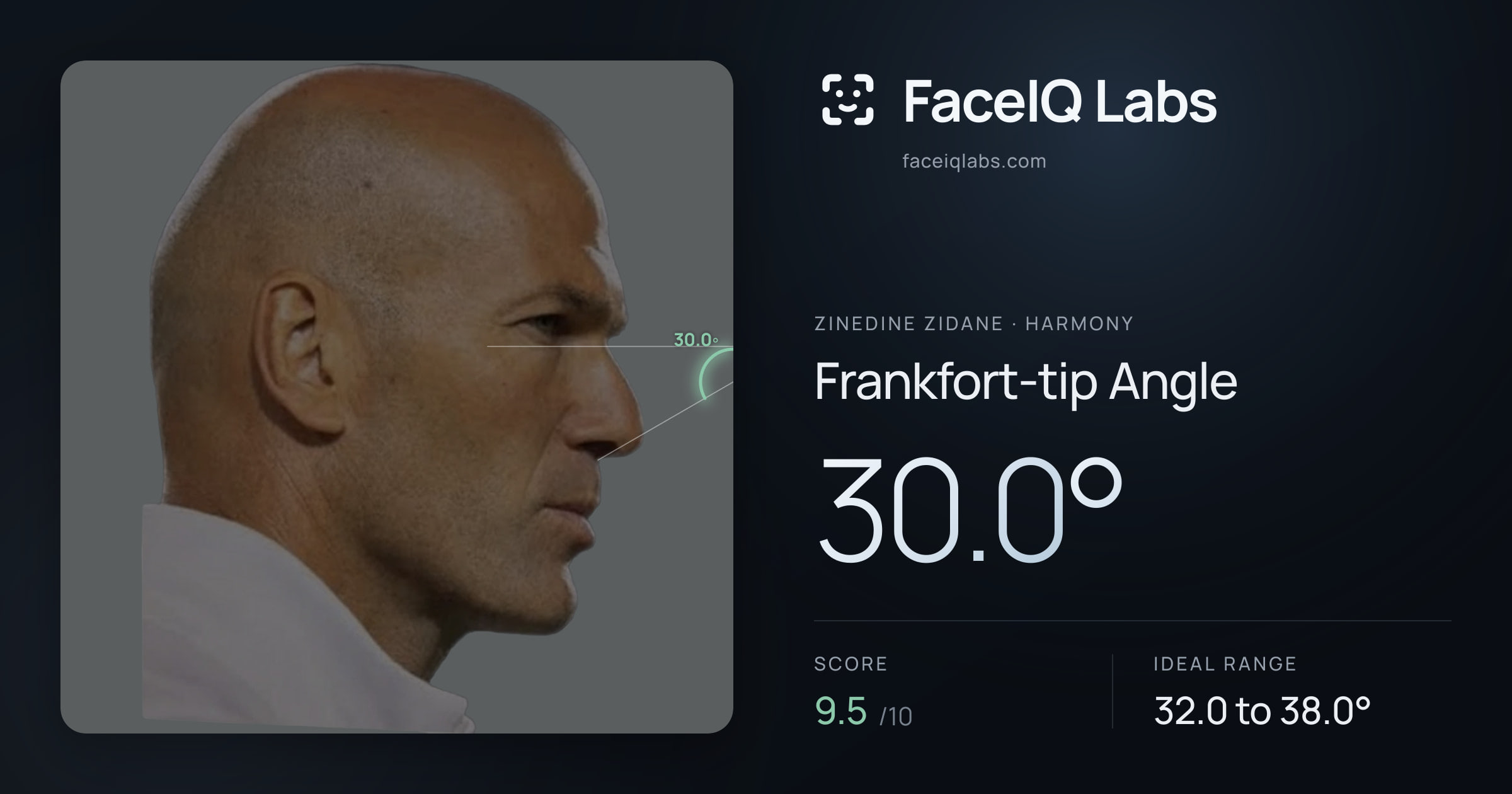 Zinedine Zidane Frankfort-tip Angle: 30.0°, drawn on the photo