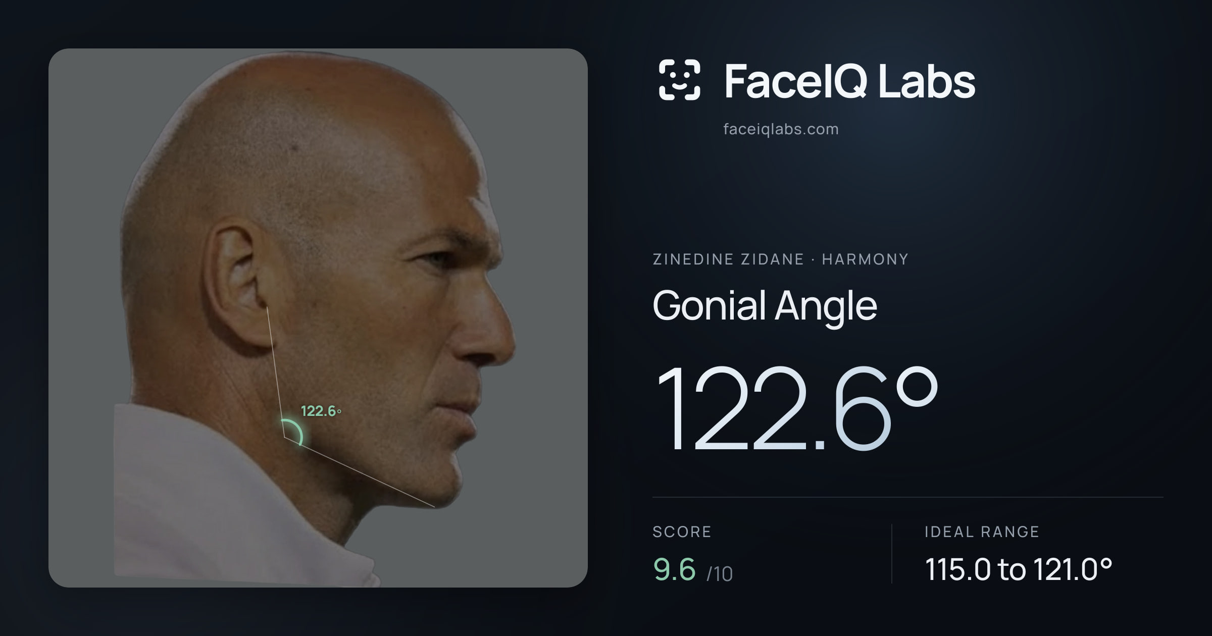Zinedine Zidane Gonial Angle: 122.6°, drawn on the photo