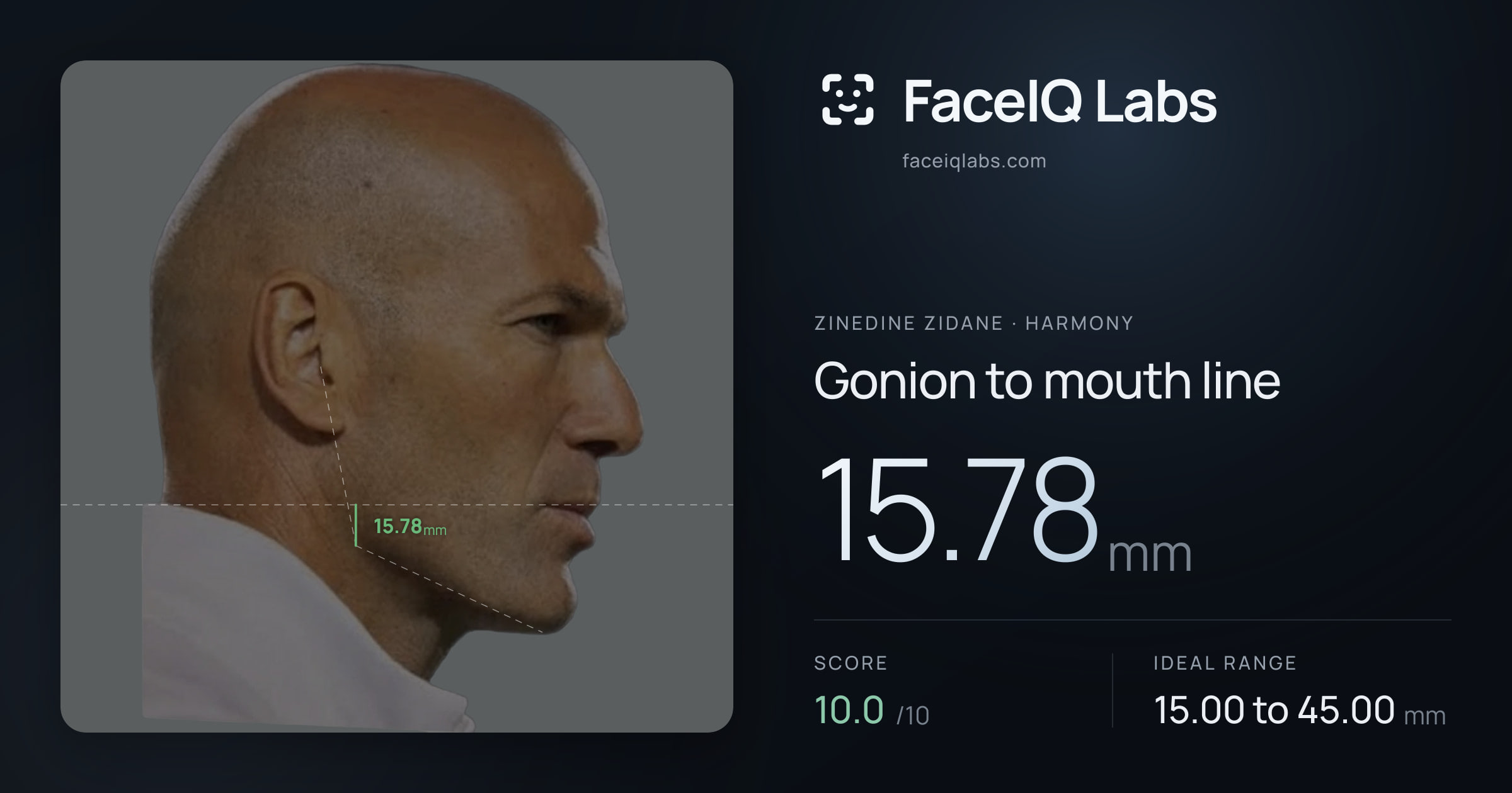 Zinedine Zidane Gonion to mouth line: 15.78mm, drawn on the photo