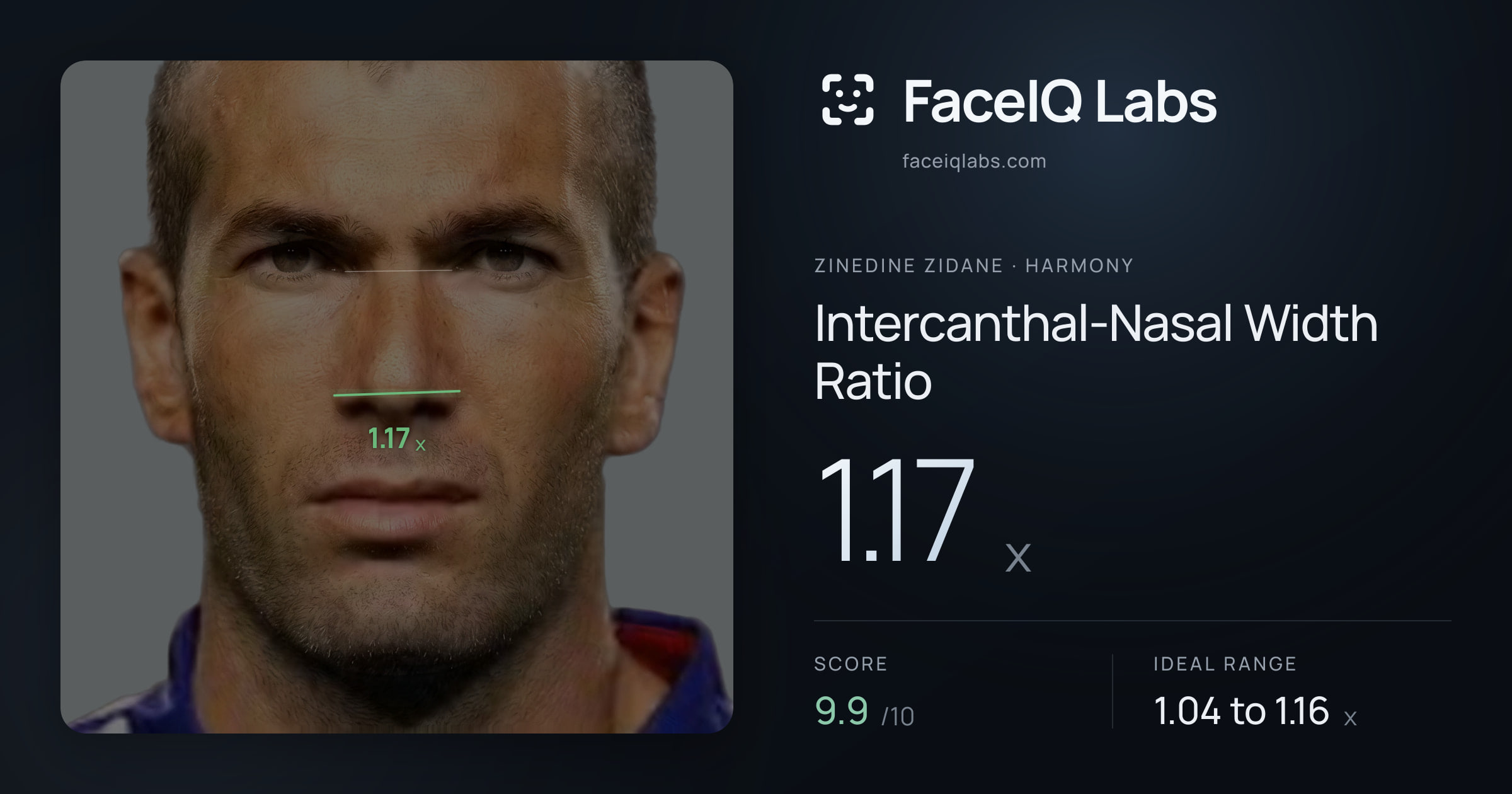 Zinedine Zidane Intercanthal-Nasal Width Ratio: 1.17x, drawn on the photo