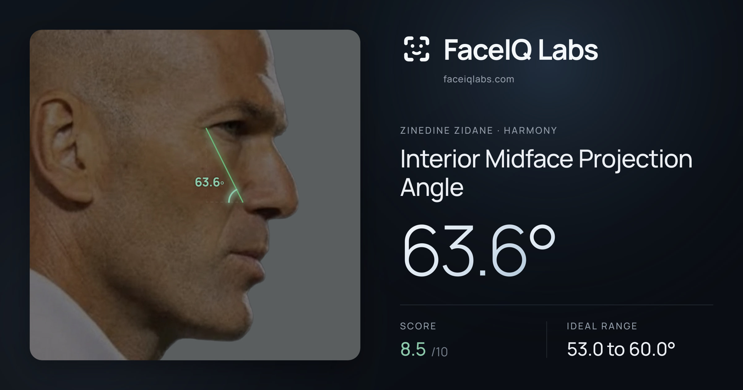 Zinedine Zidane Interior Midface Projection Angle: 63.6°, drawn on the photo