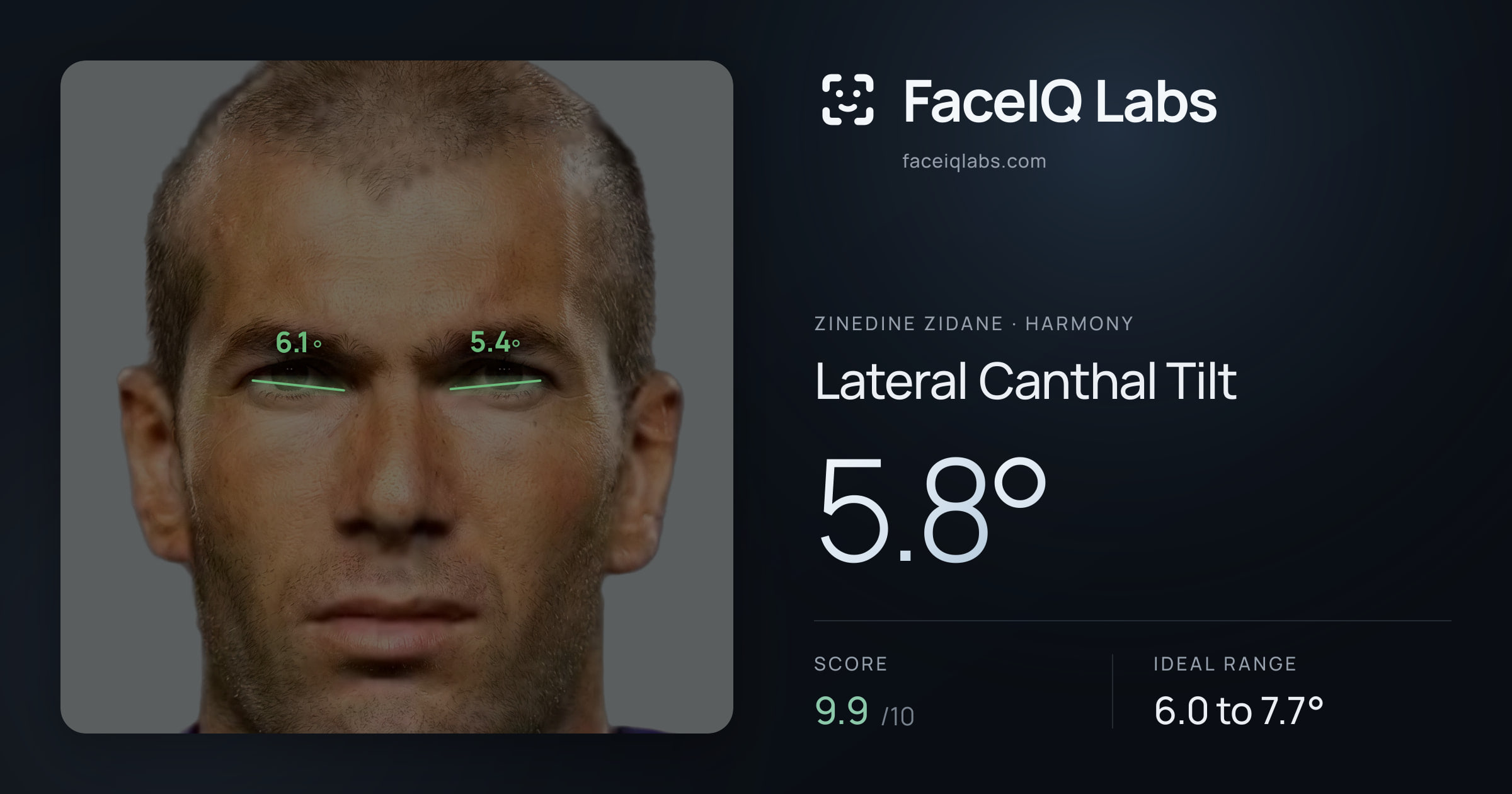 Zinedine Zidane Lateral Canthal Tilt: 5.8°, drawn on the photo