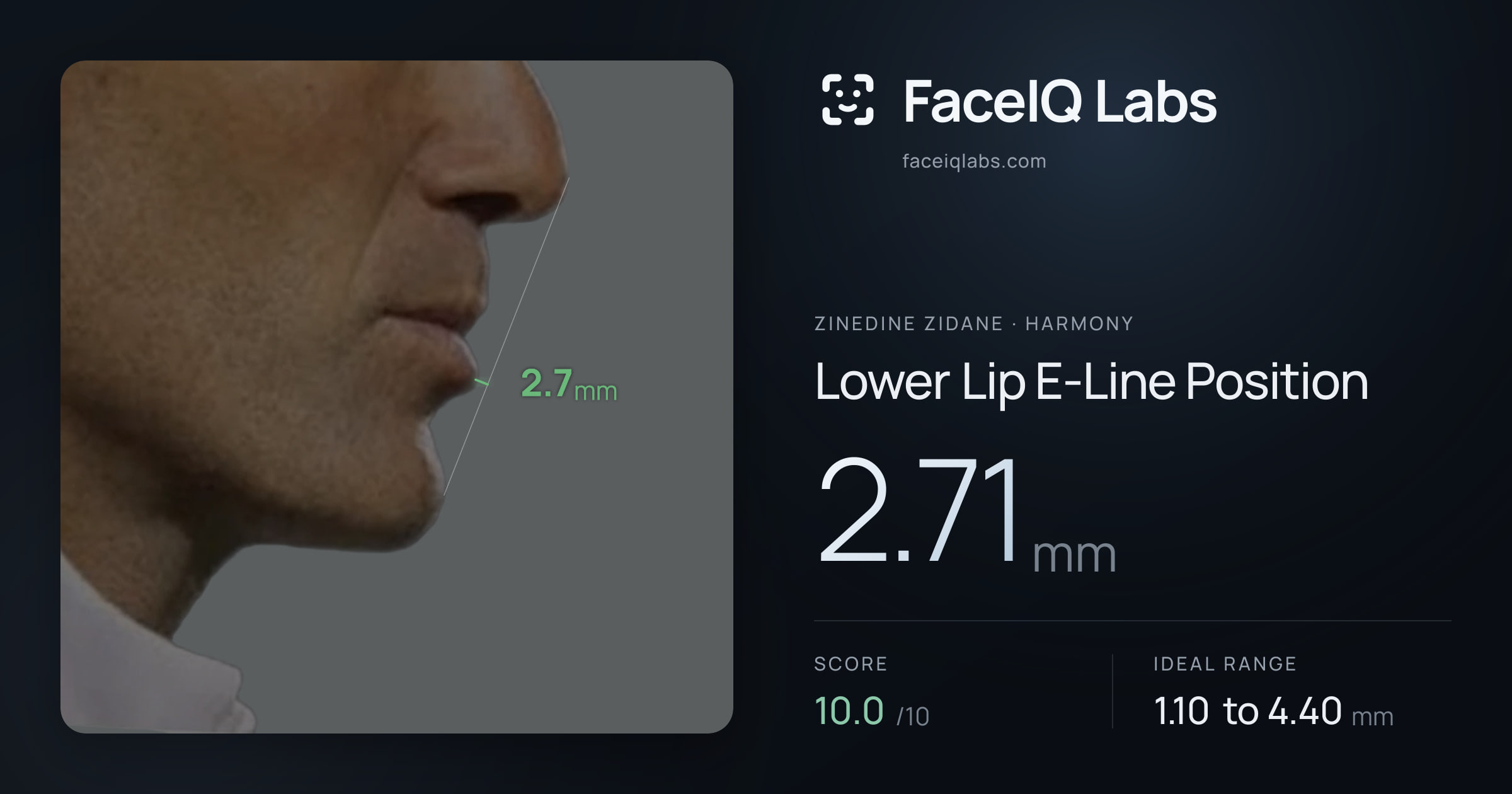 Zinedine Zidane Lower Lip E-Line Position: 2.71mm, drawn on the photo