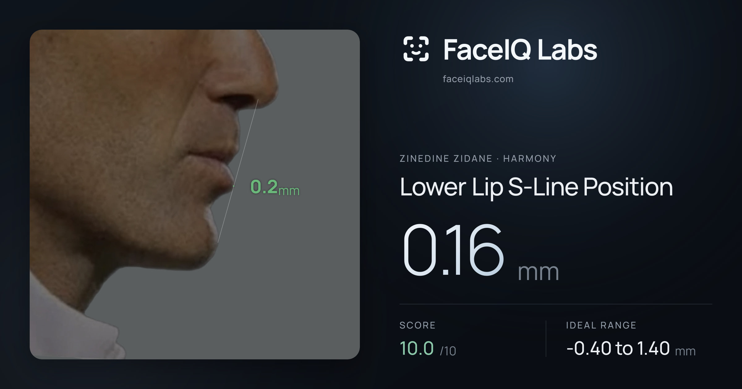 Zinedine Zidane Lower Lip S-Line Position: 0.16mm, drawn on the photo