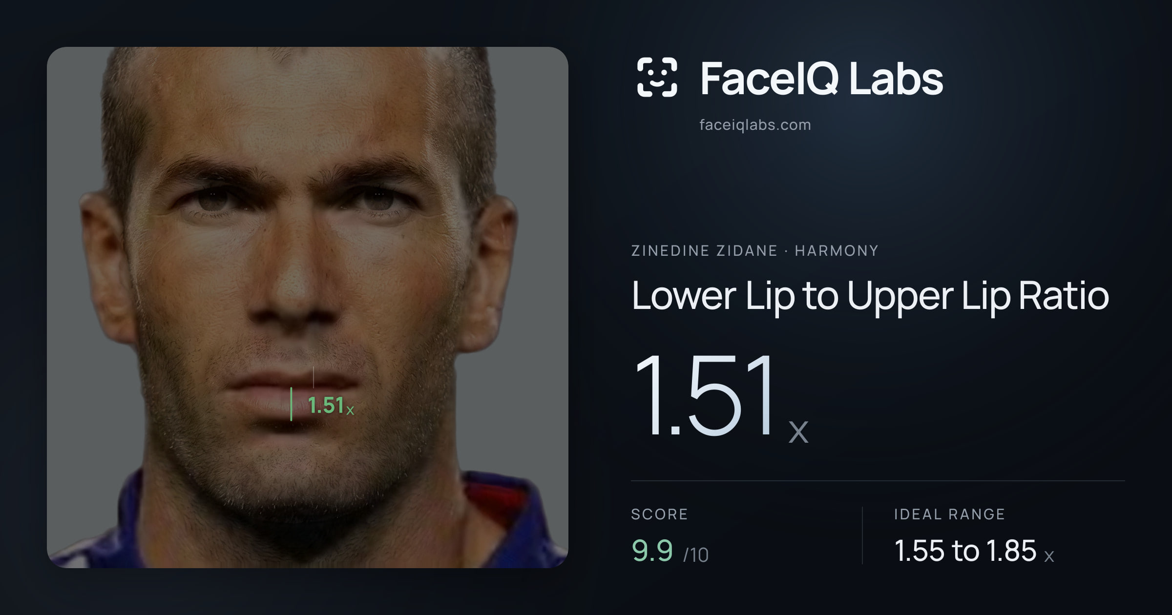 Zinedine Zidane Lower Lip to Upper Lip Ratio: 1.51x, drawn on the photo
