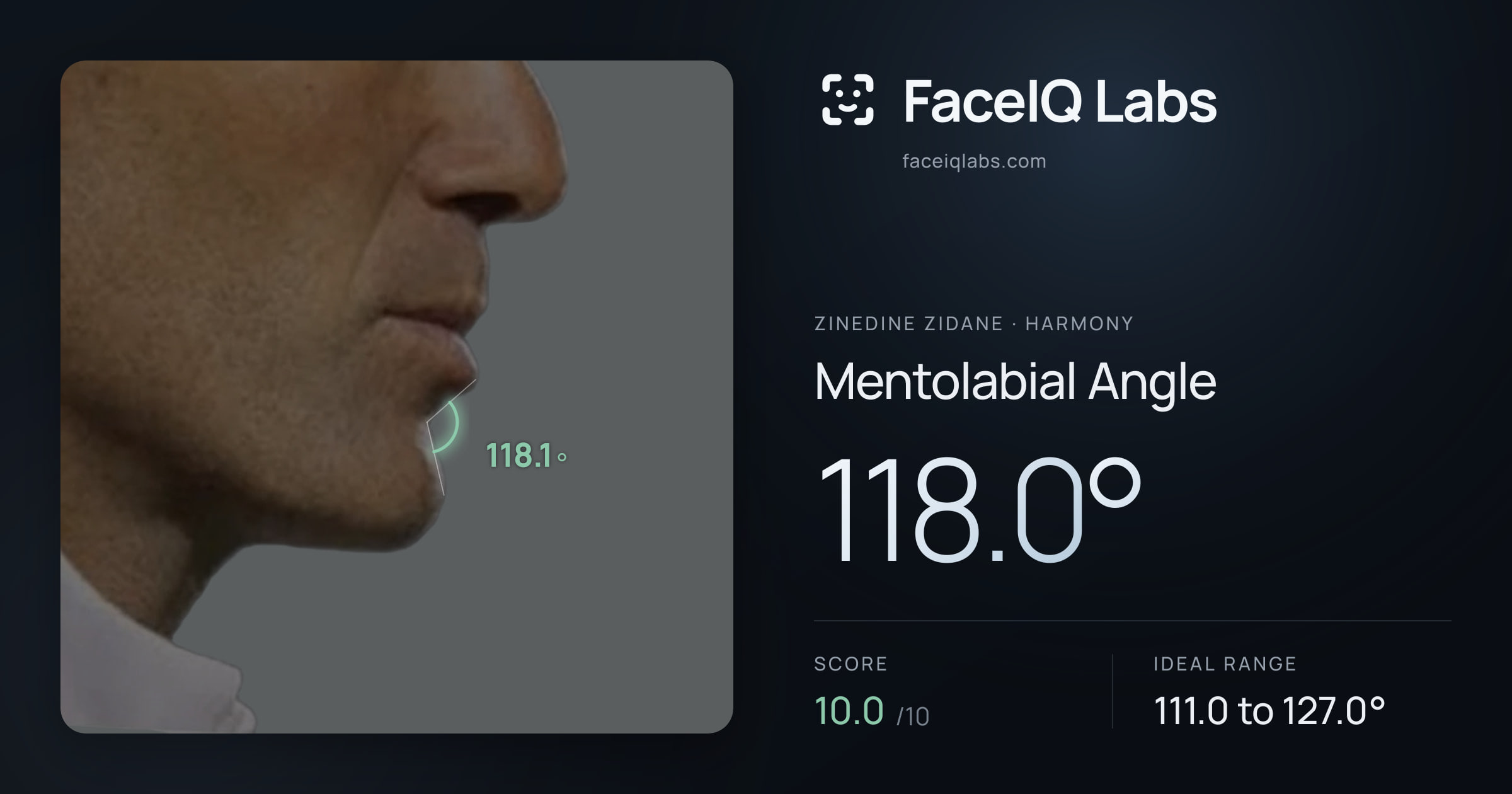Zinedine Zidane Mentolabial Angle: 118.0°, drawn on the photo